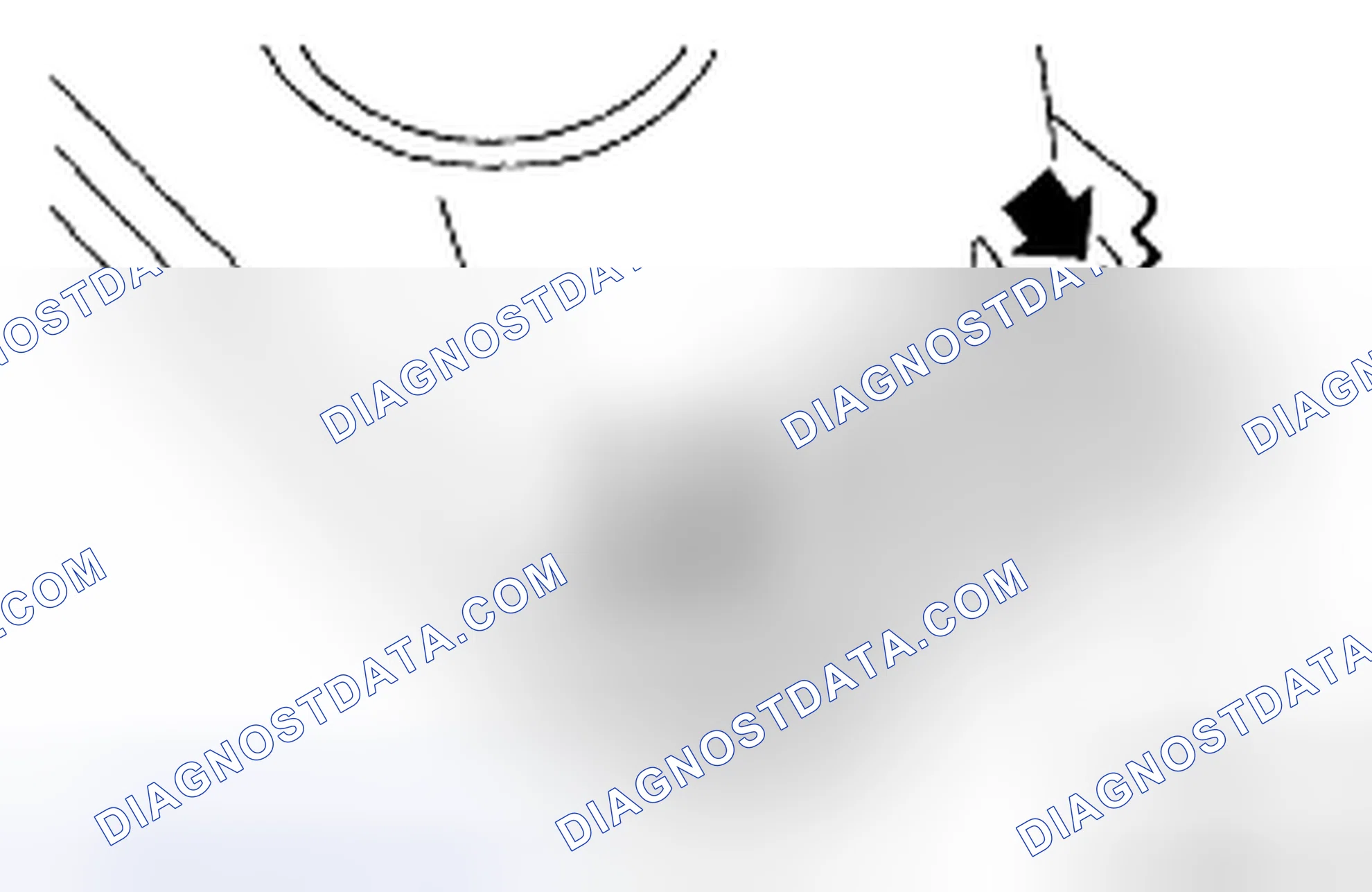 Scheme 70: Locating Air Cleaner Upper Cover