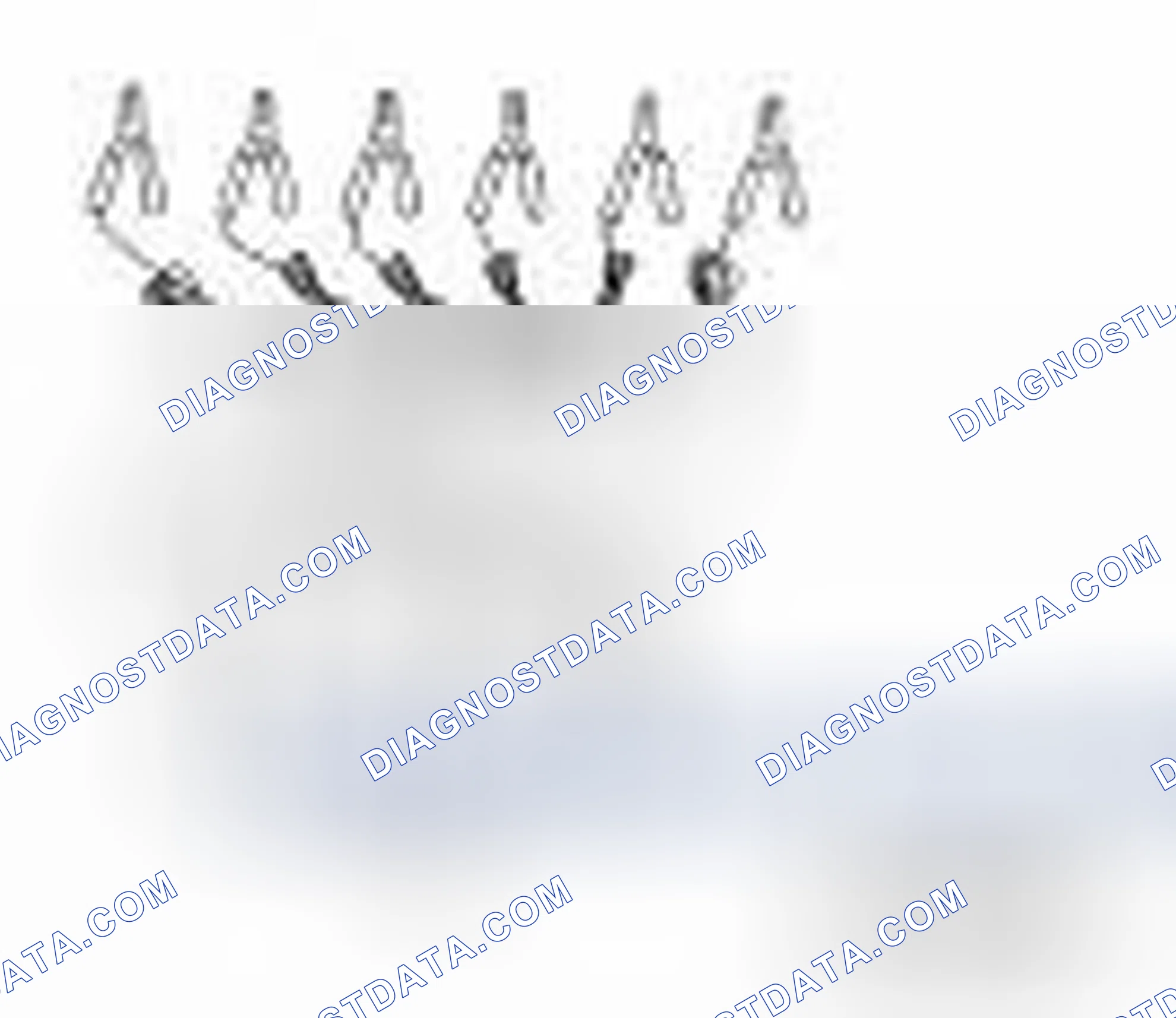 Scheme 118: Special Service Tools