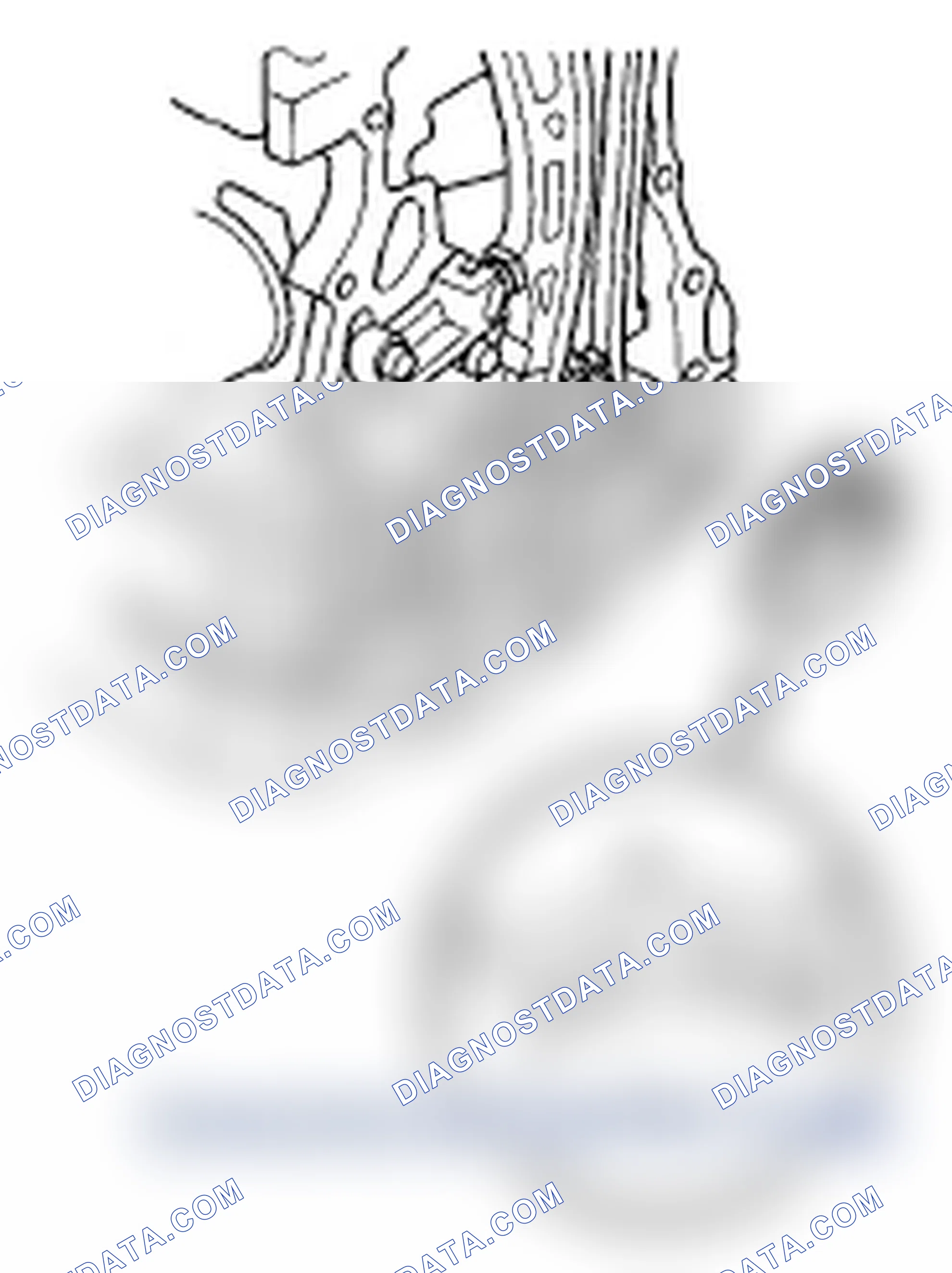 Scheme 76: CKP Pulse Plate Replacement