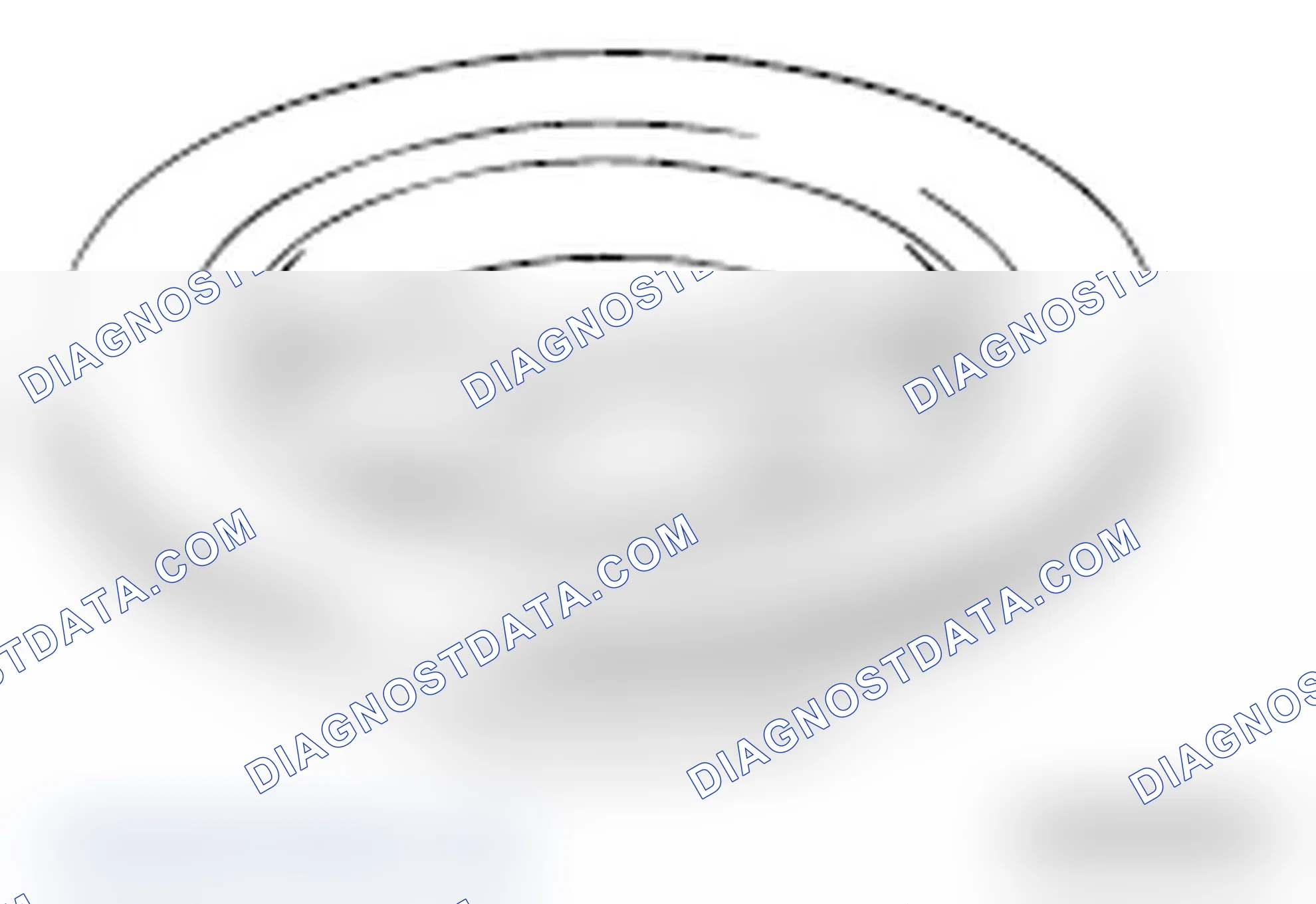Scheme 25: BRAKE DRUM INSIDE DIAMETER CHECK