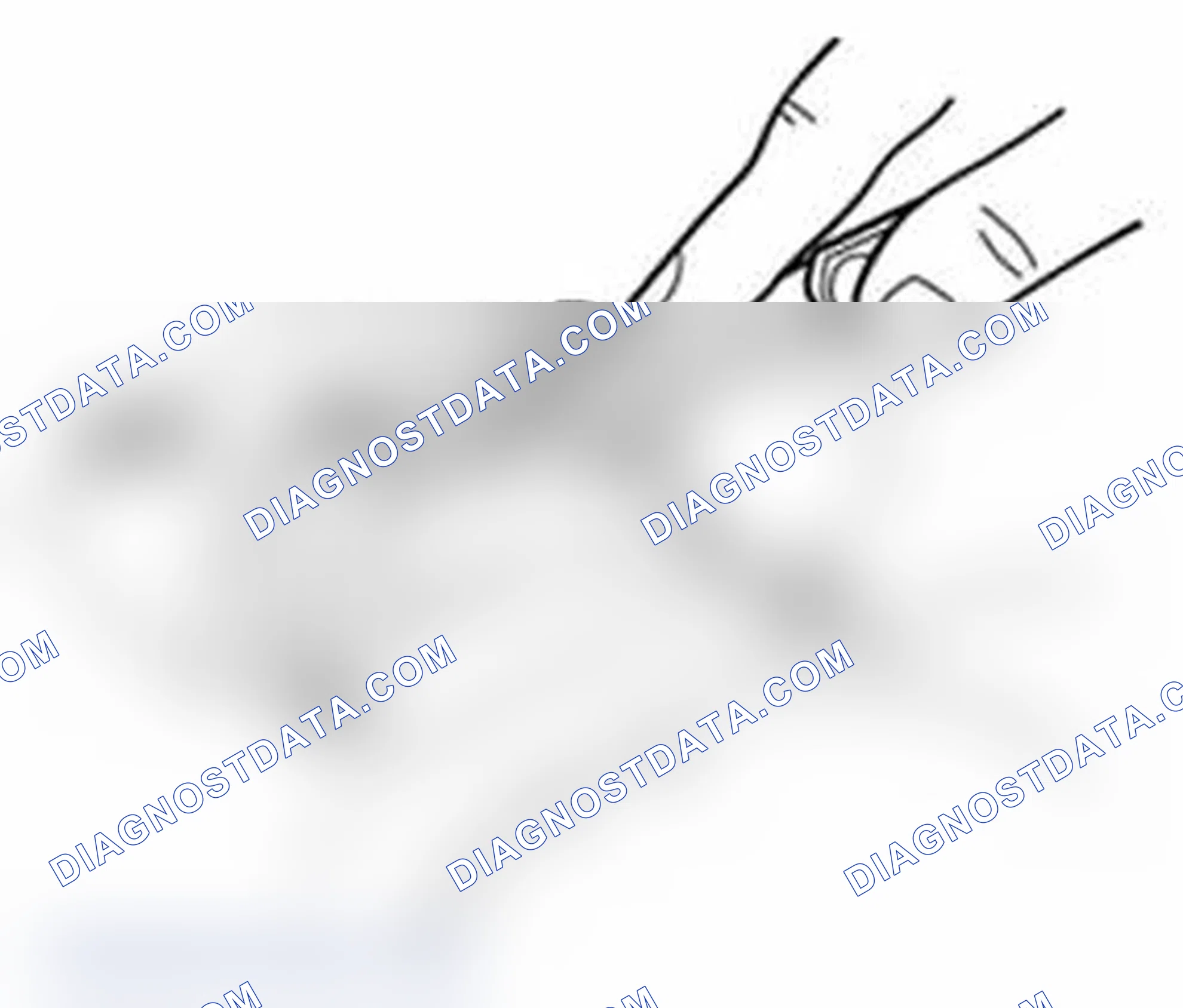 Scheme 166: Big-end side clearance