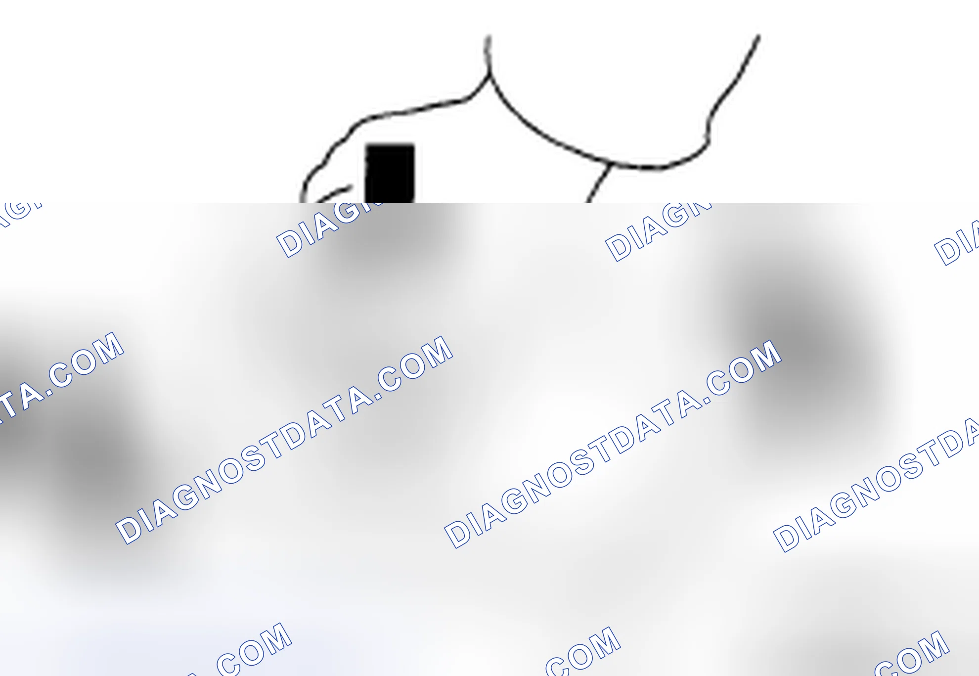 Scheme 88: INSTALLATION