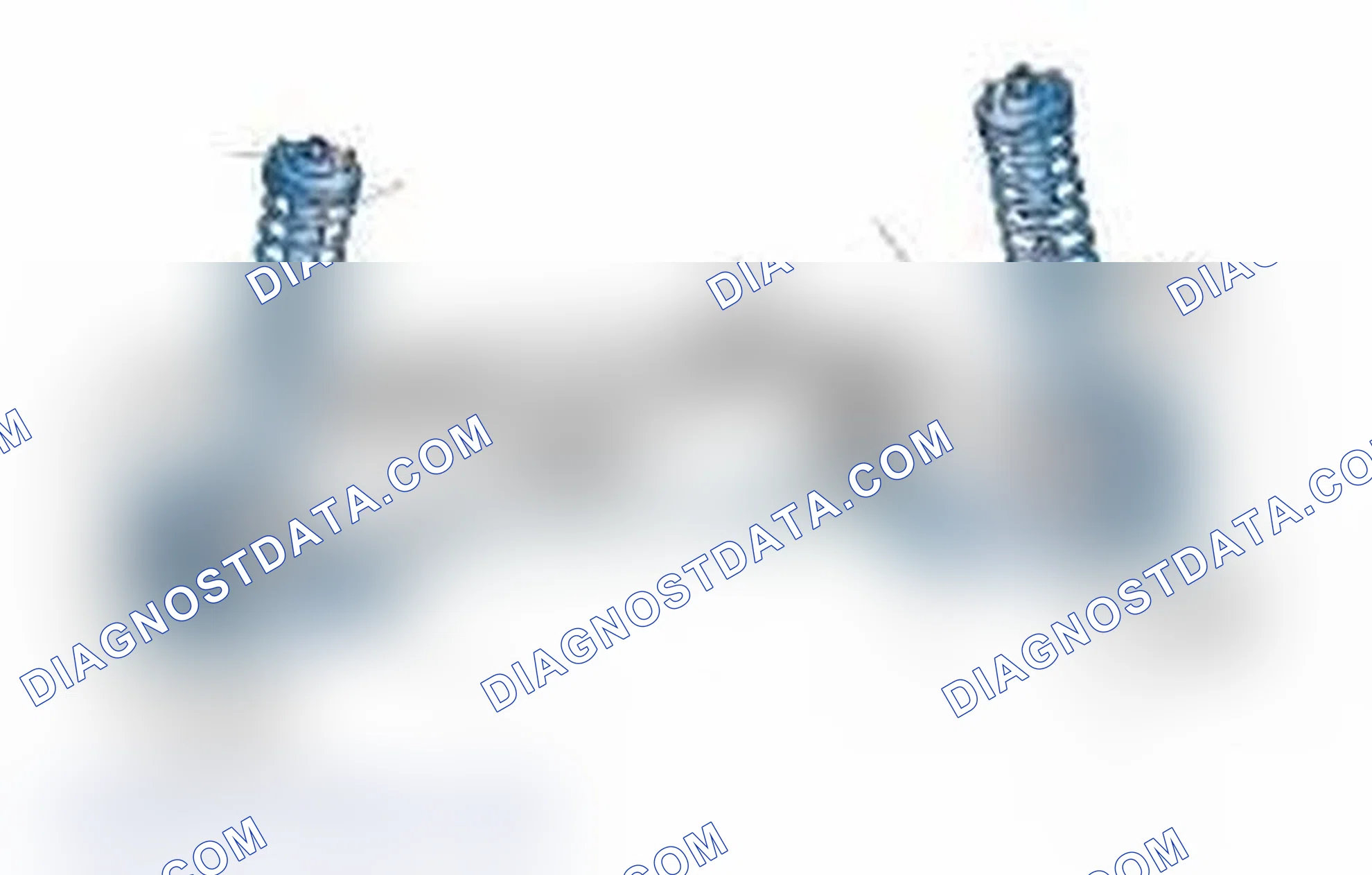 Scheme 25: Typical Front Suspension & Steering Components
