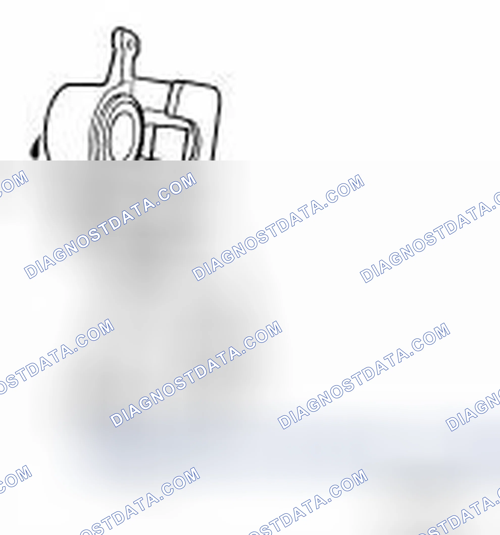 Fig. 49: Checking Caliper For Fluid Leakage