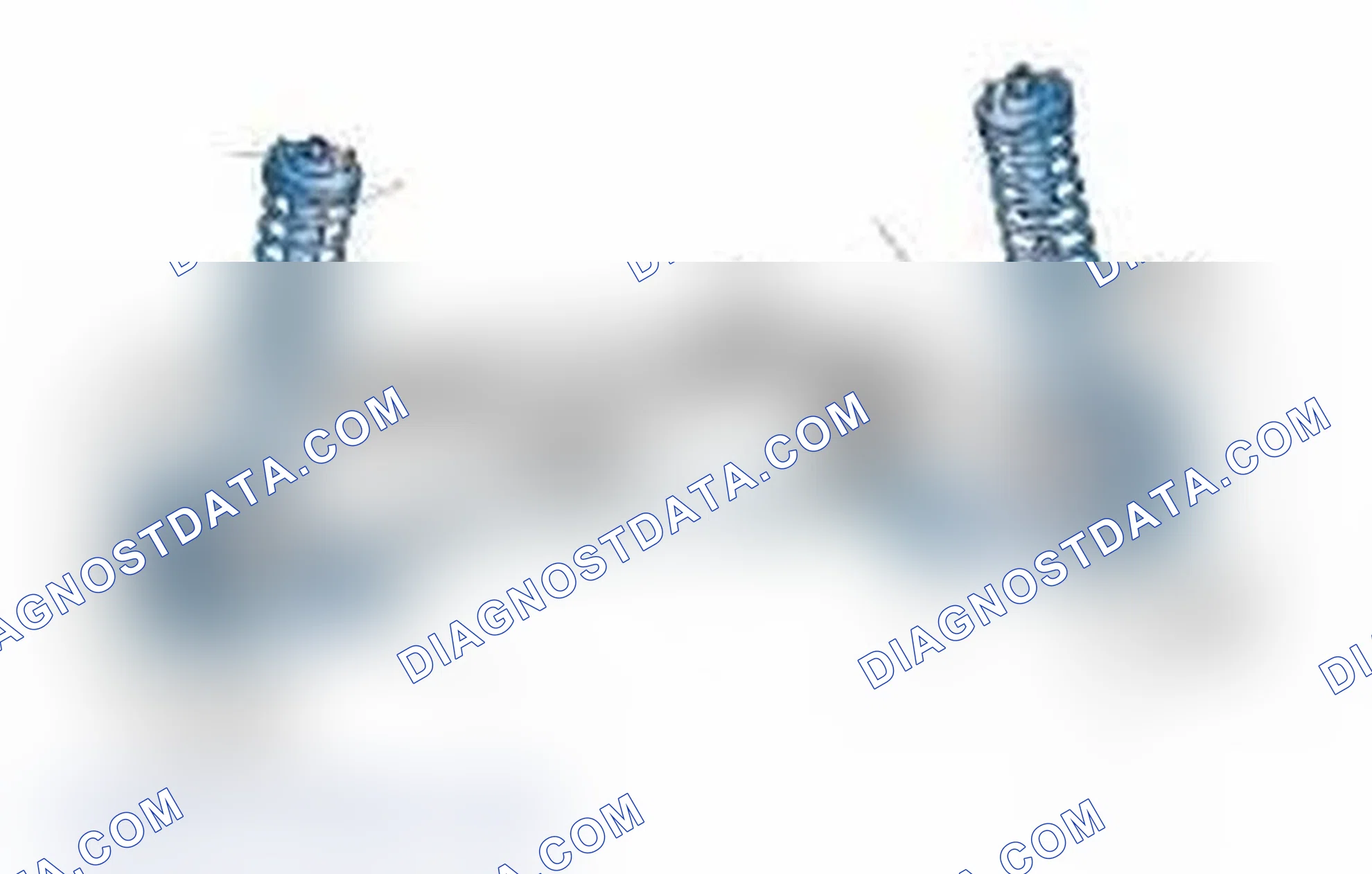 Scheme 25: Typical Front Suspension & Steering Components