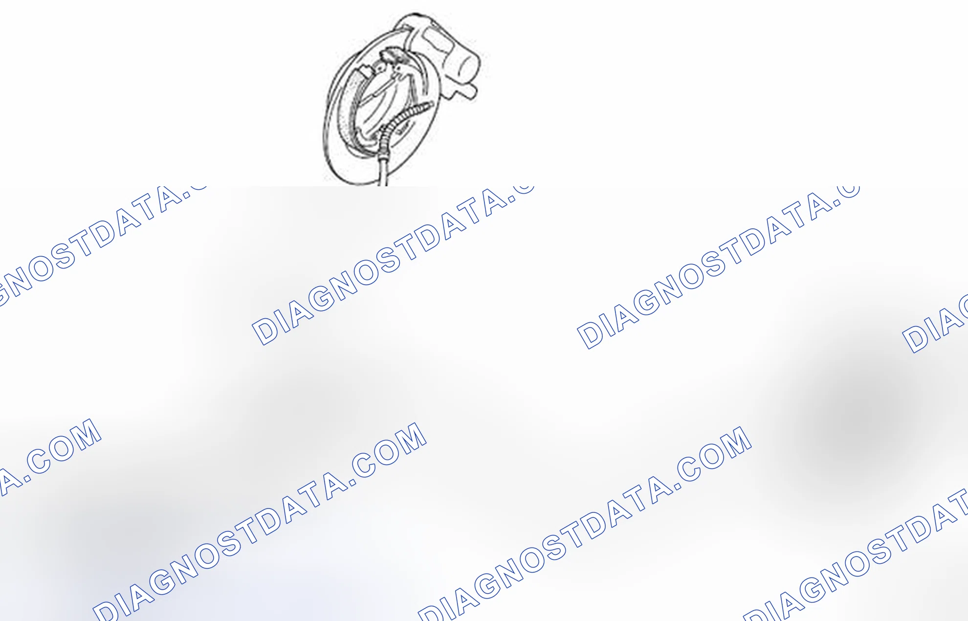 Scheme 1: Parking Brake