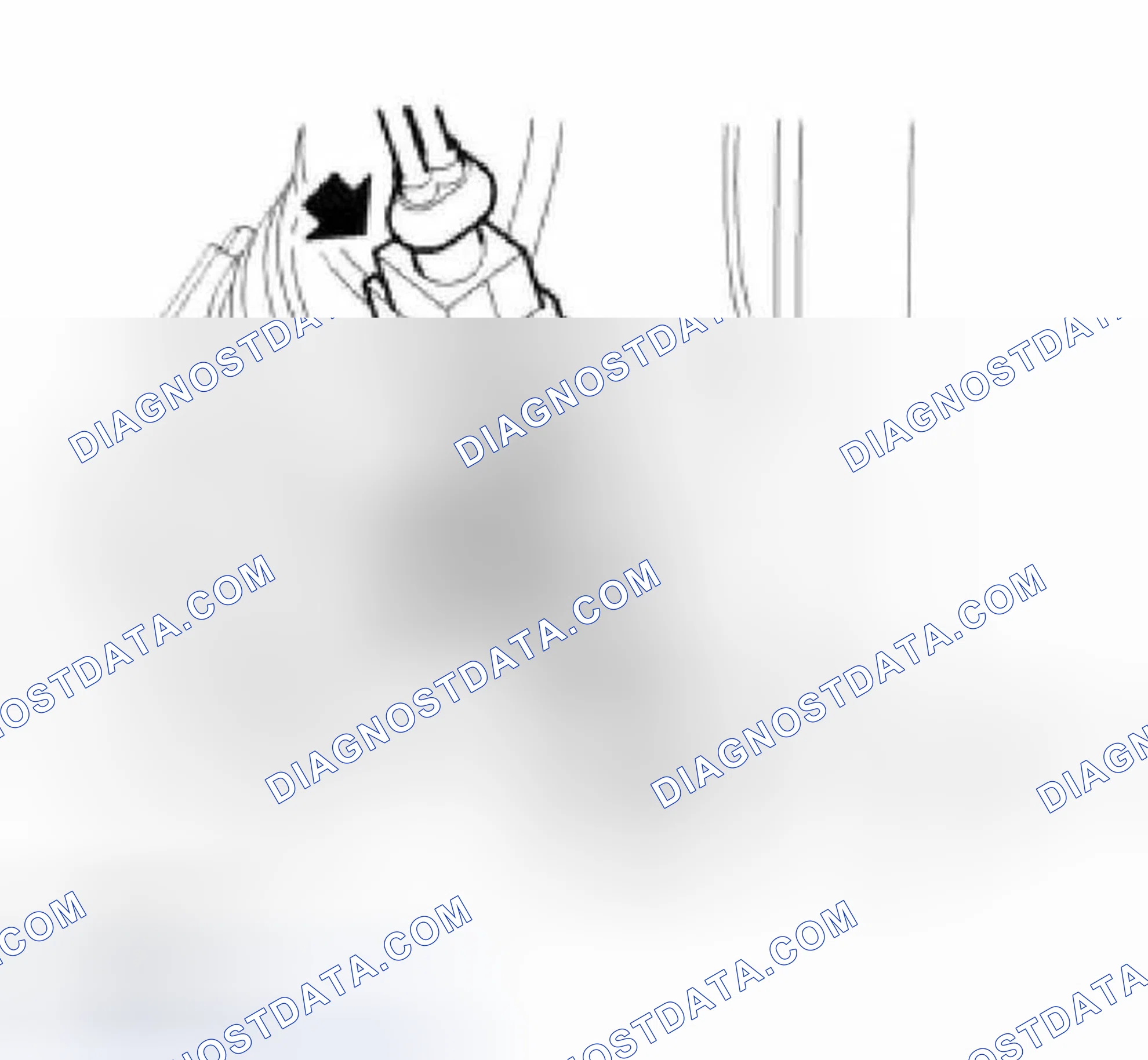 Scheme 16: Remove
