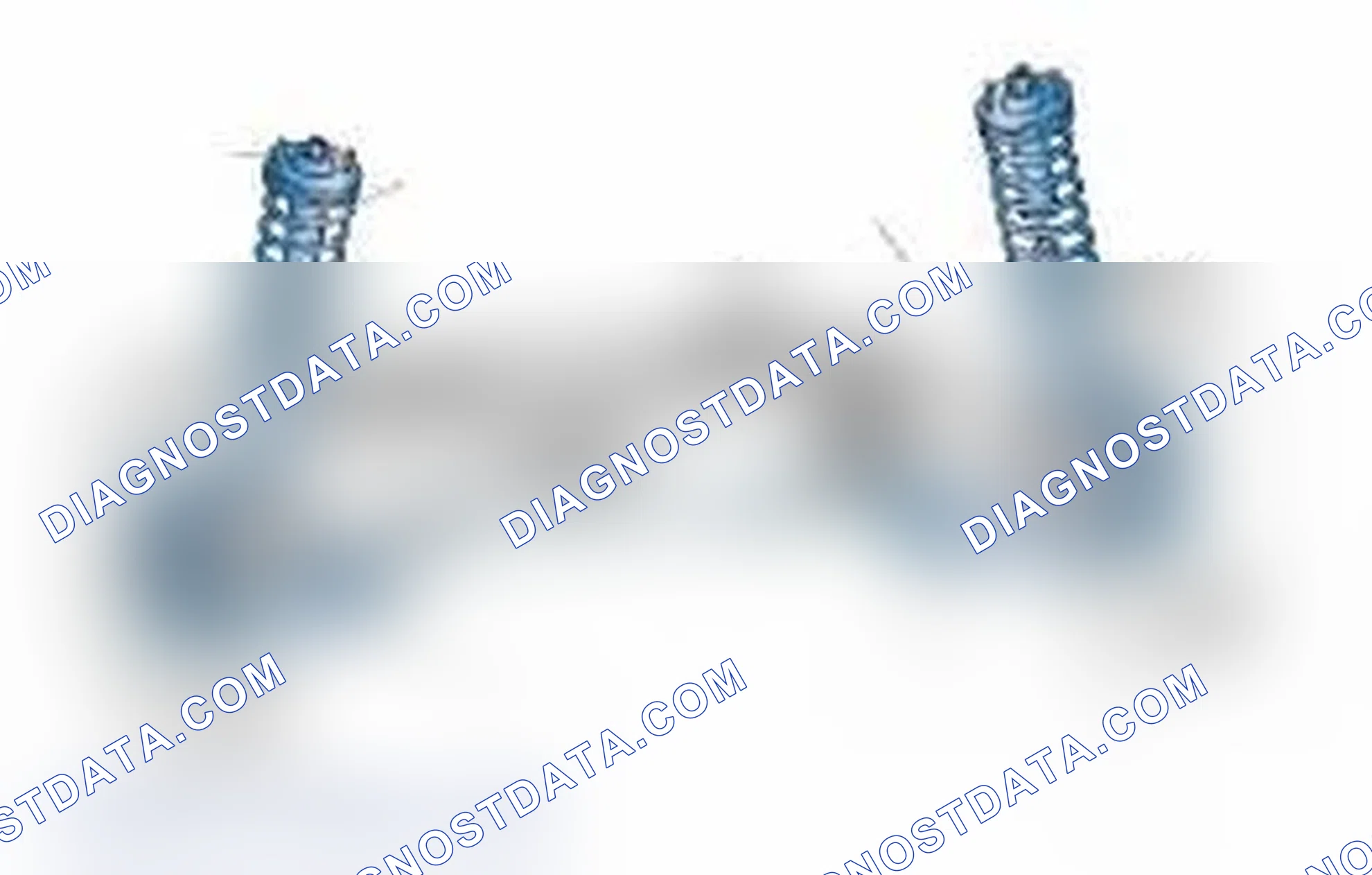 Scheme 25: Typical Front Suspension & Steering Components