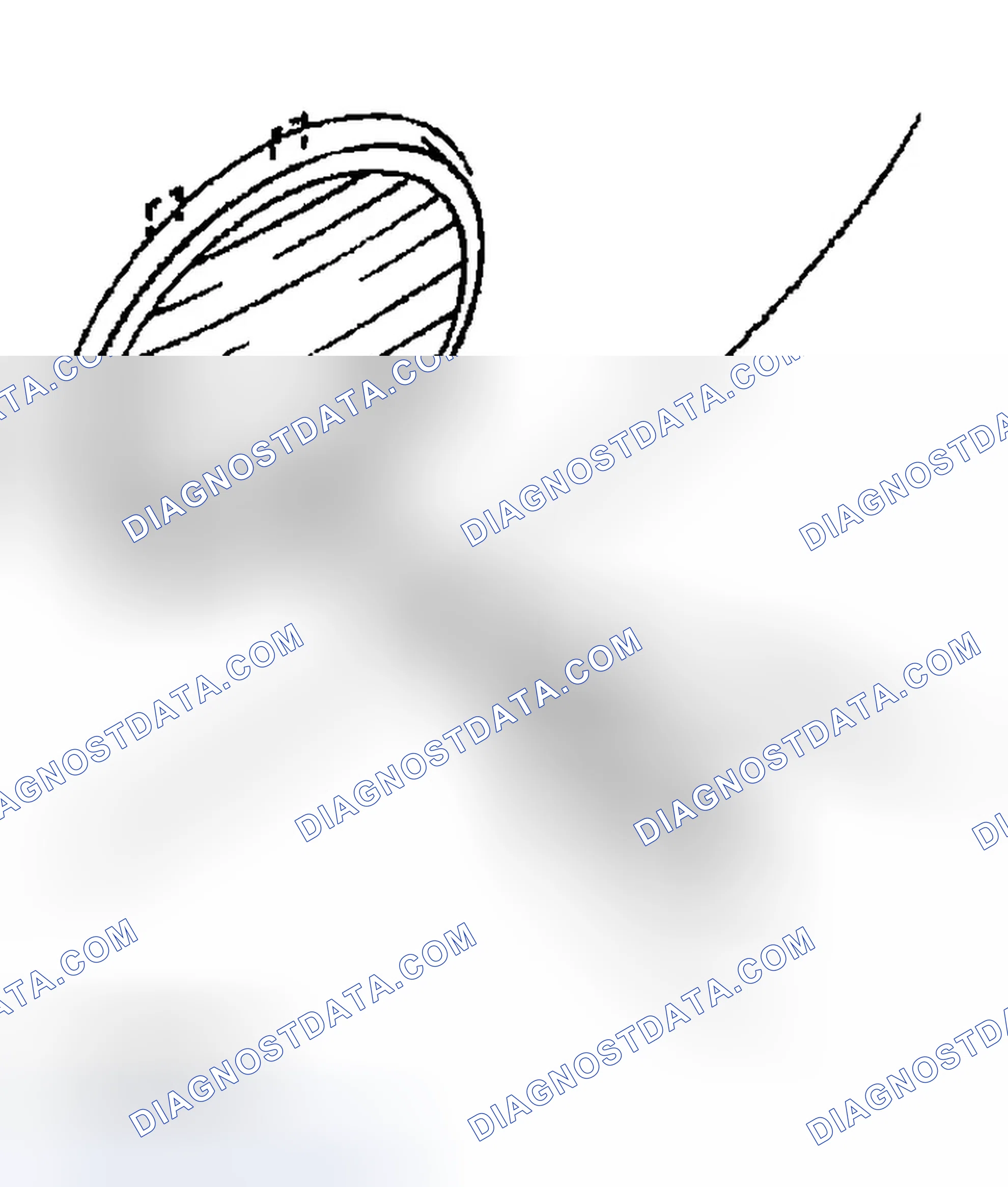 Scheme 72: LENS REMOVAL NOTE