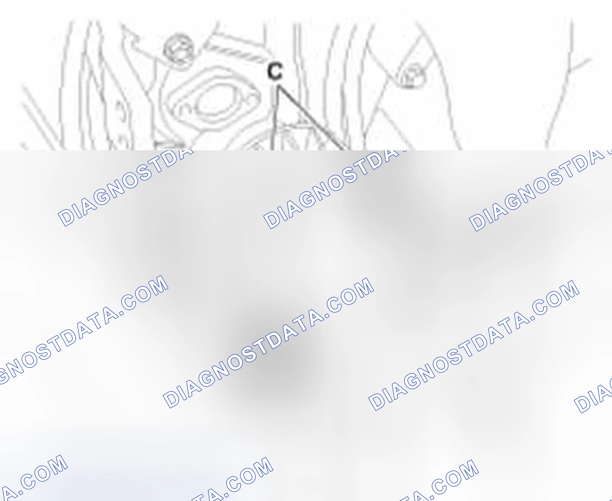 Scheme 148: Removal