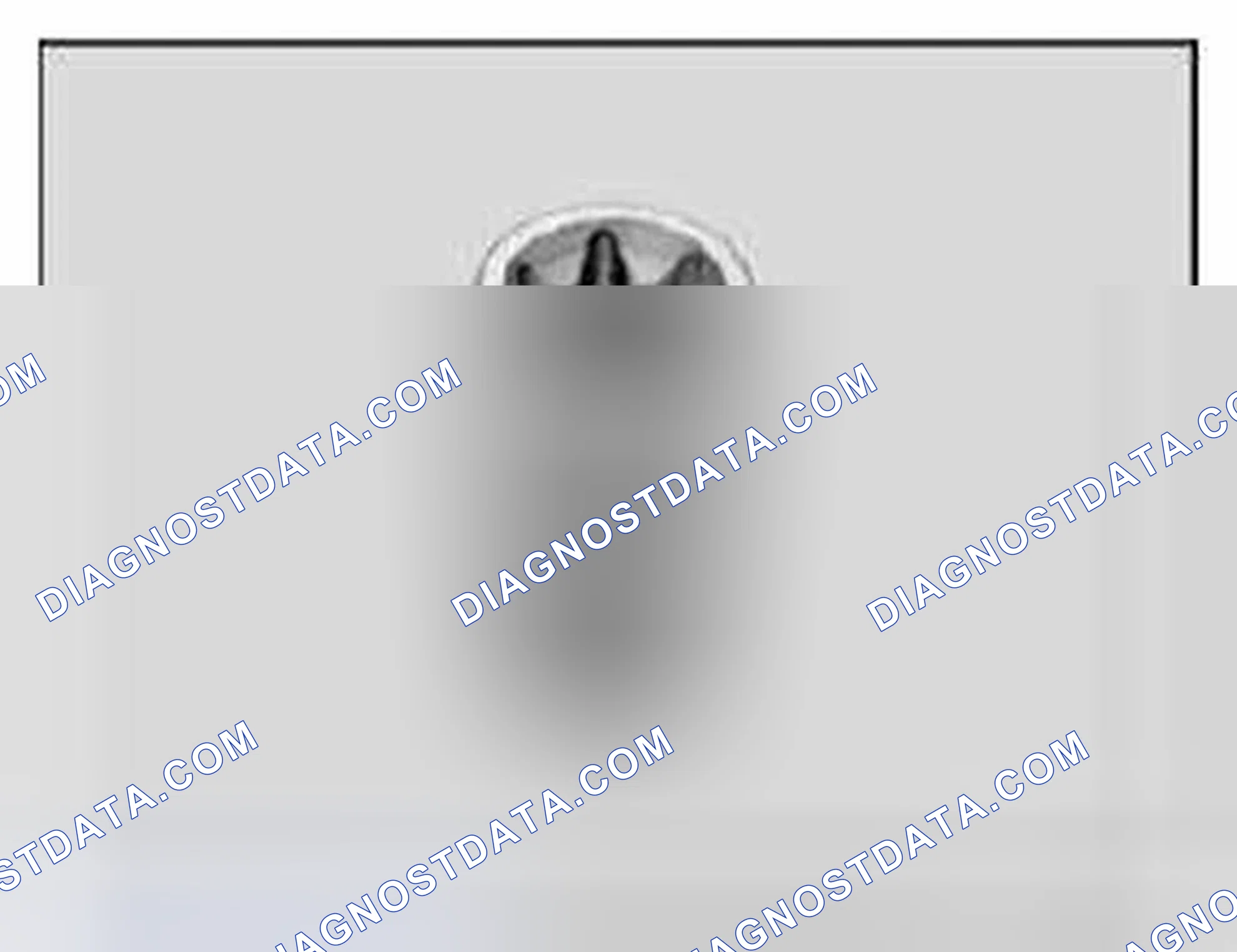 Scheme 423: 11 8 640 Torx socket E10