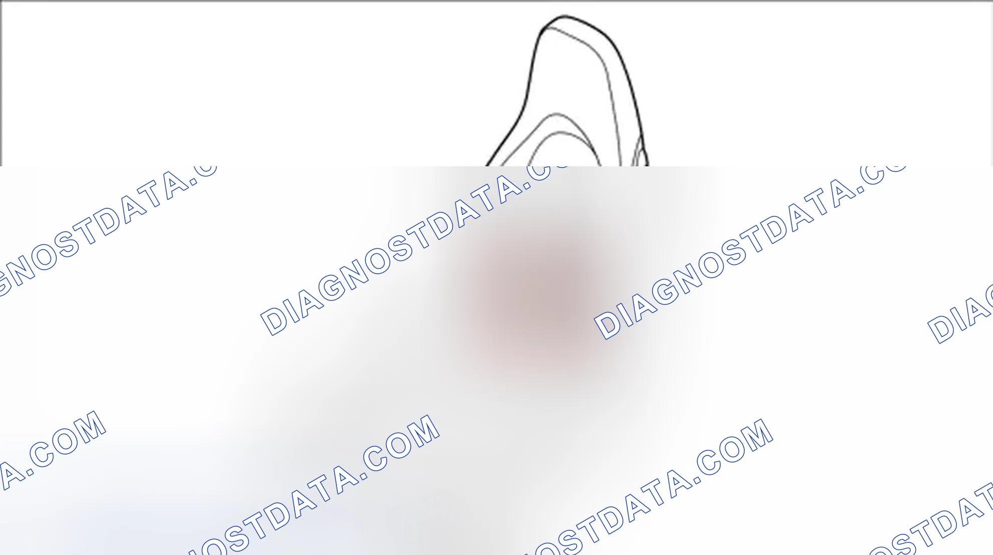Scheme 139: Removing lumbar support