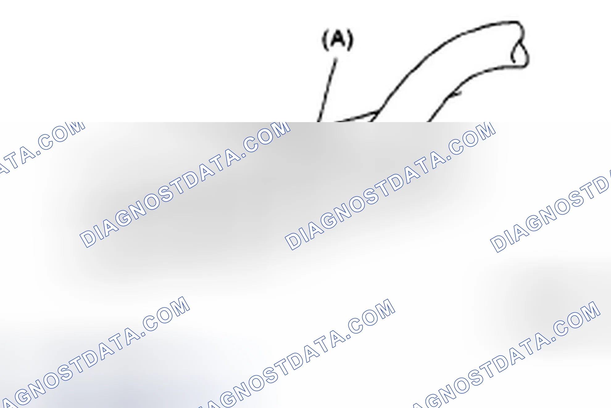 Scheme 36: LENS