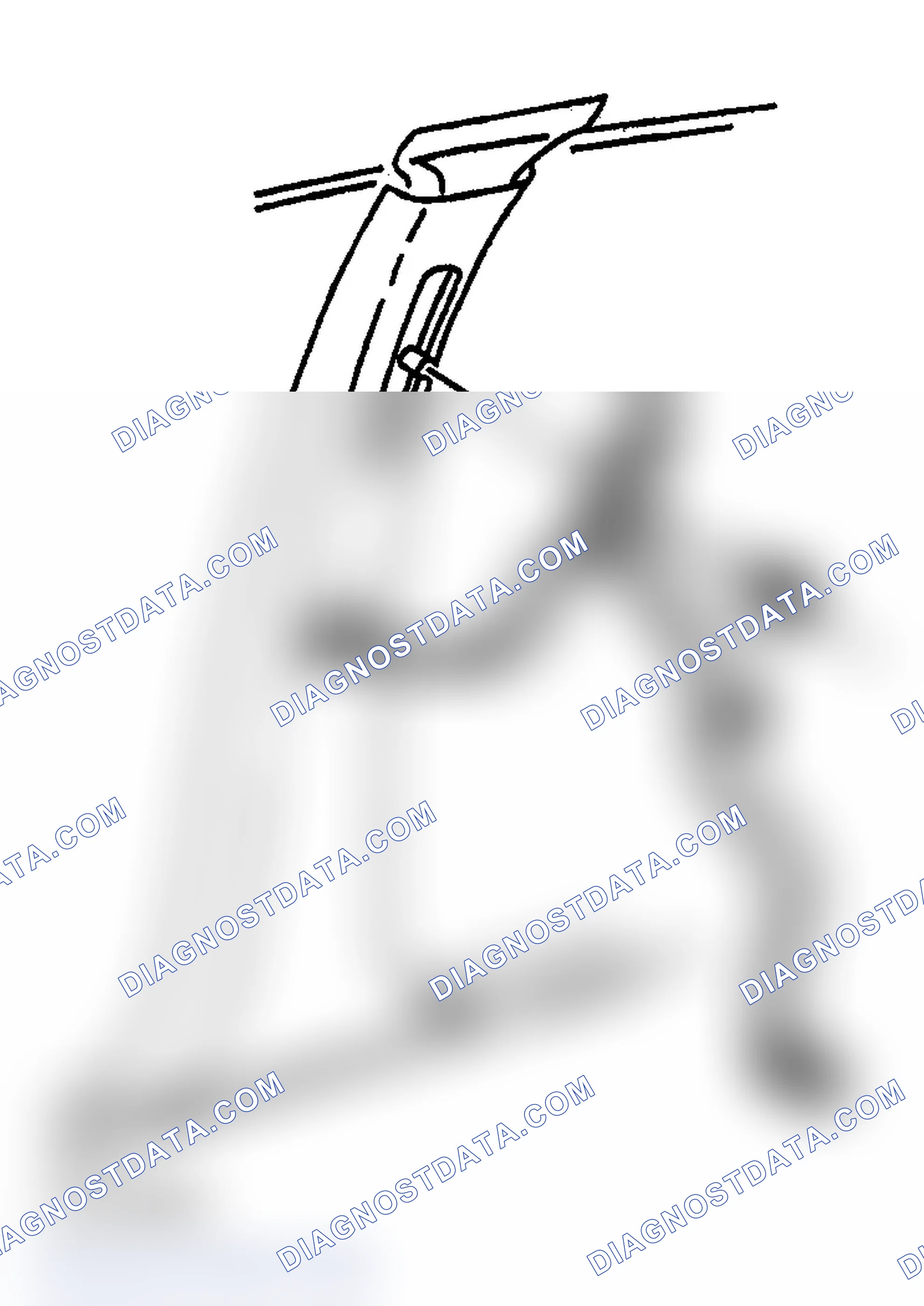 Scheme 17: Removal Procedure