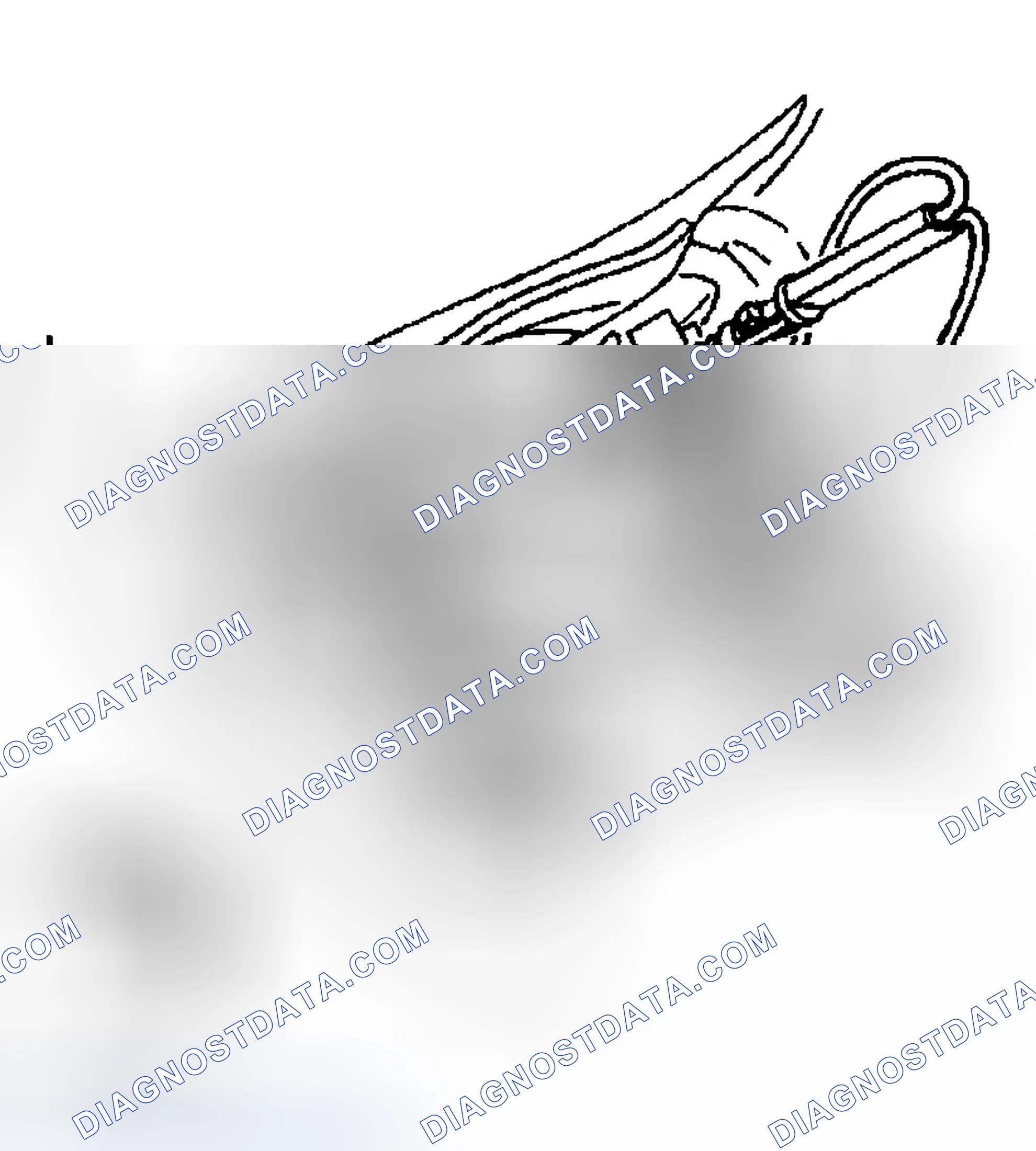 Scheme 30: Removal Procedure