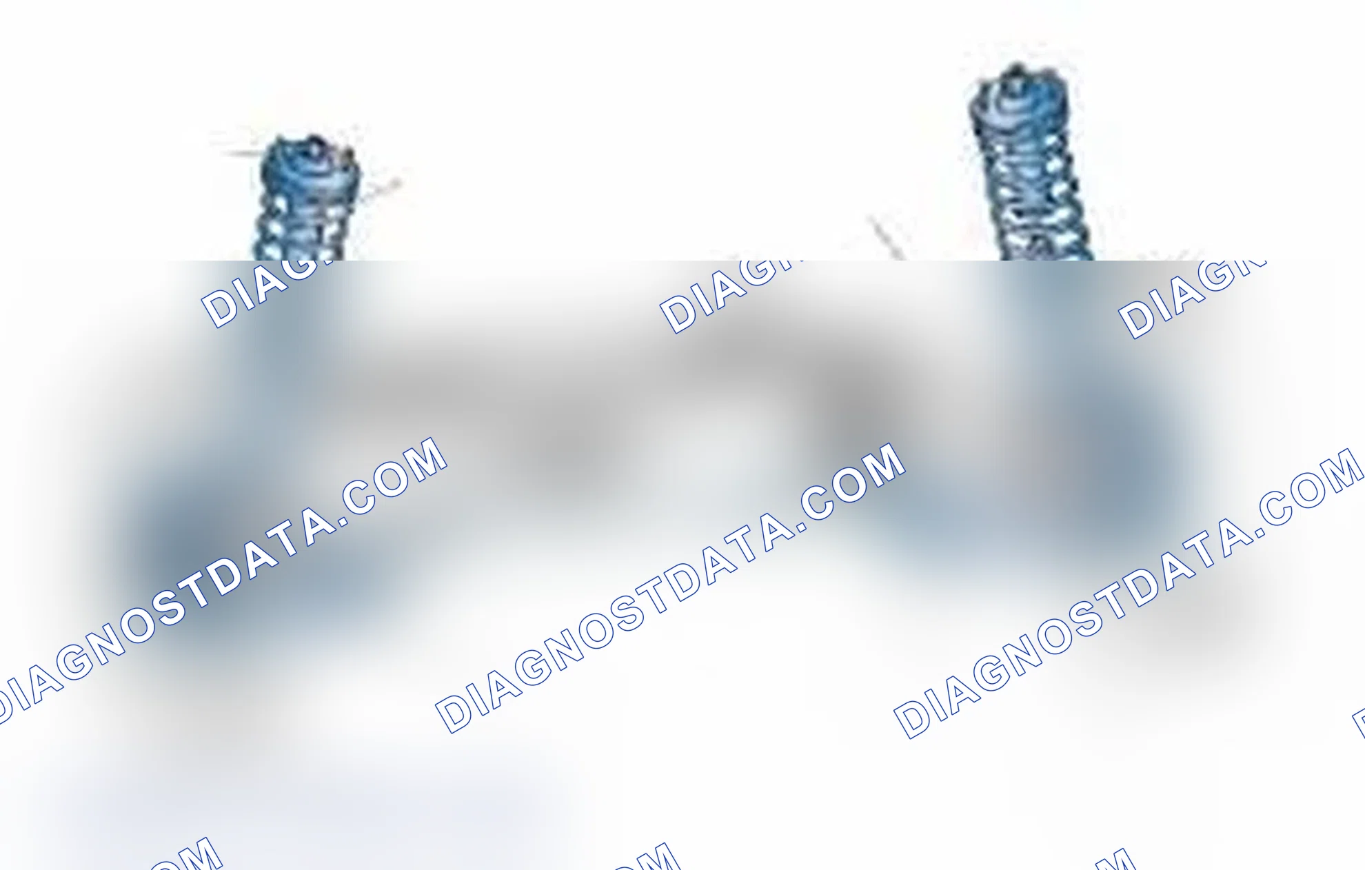 Scheme 25: Typical Front Suspension & Steering Components
