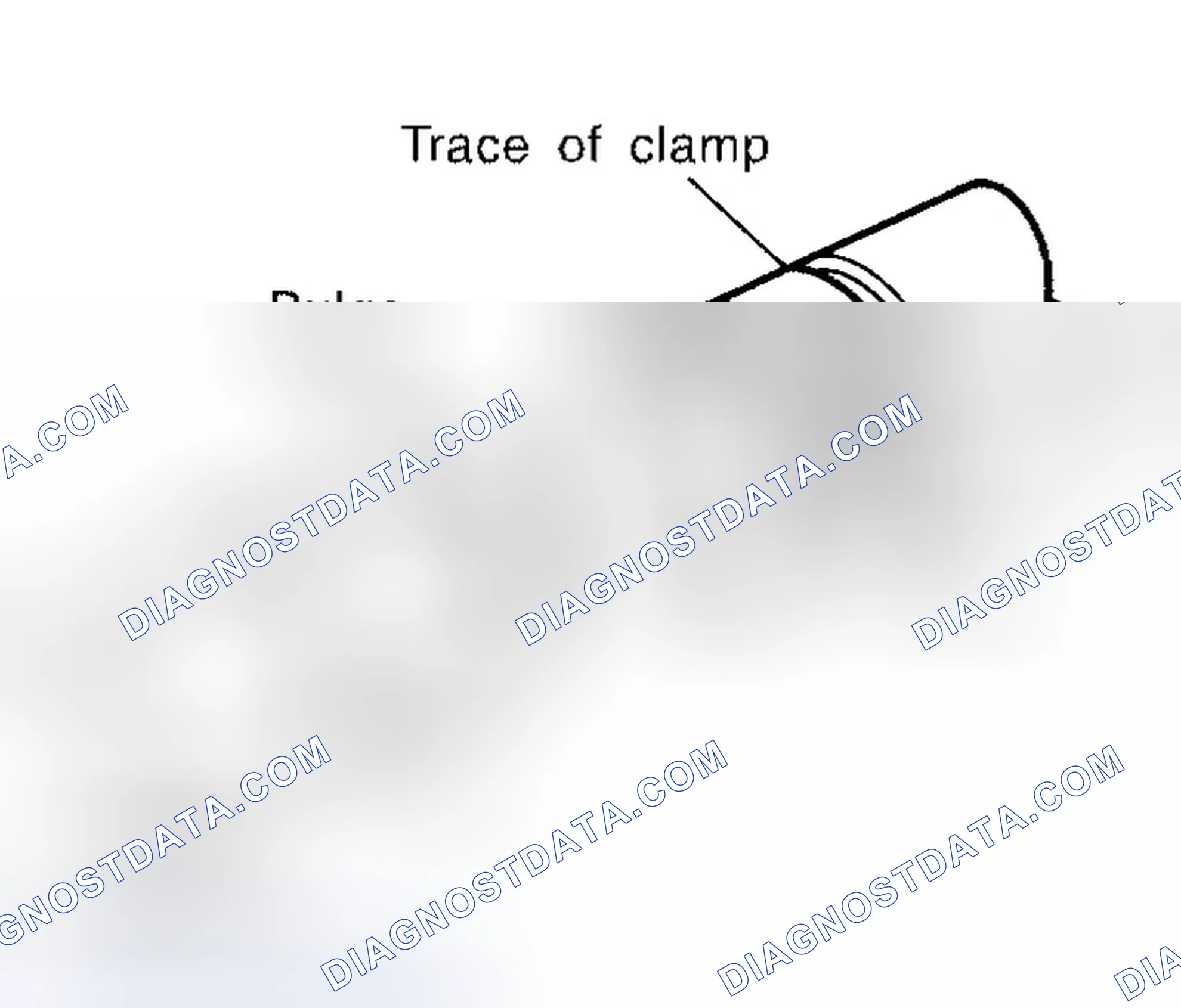 Scheme 33: HOSE CLAMPING