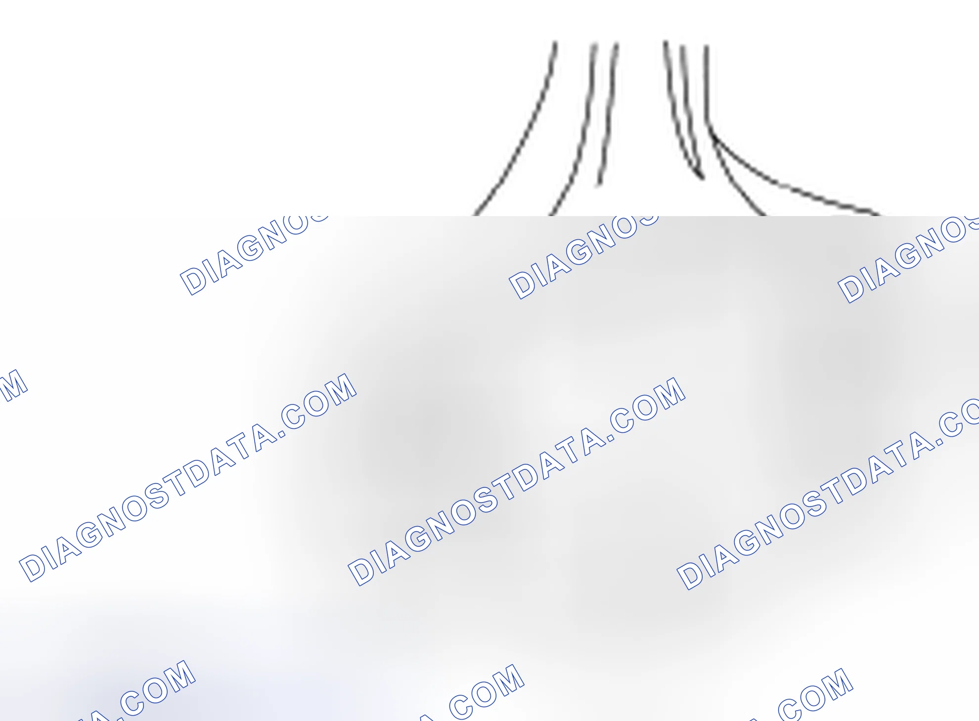 Scheme 62: Connecting Rod Large End Bore