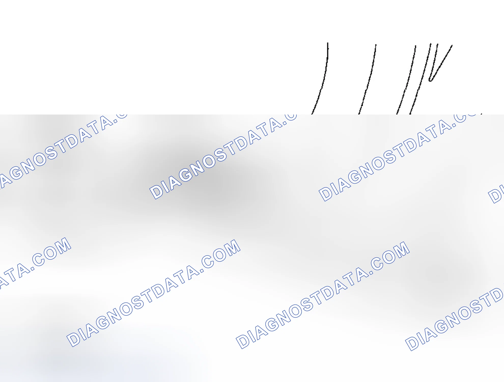 Scheme 61: Removing Lens & Detaching Bulb