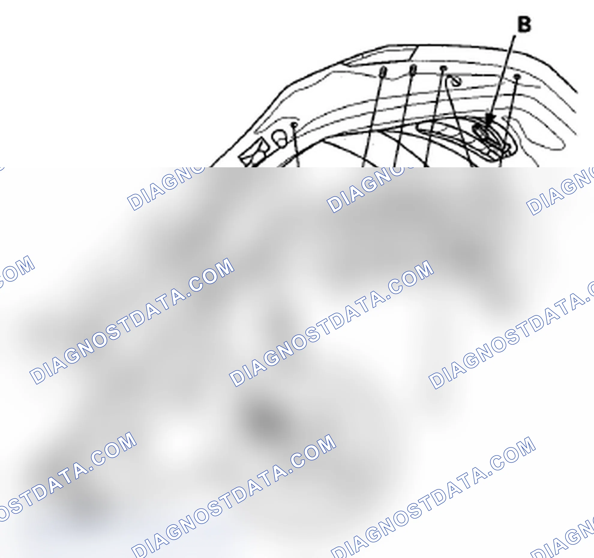 Scheme 262: Pinch Sensor Replacement