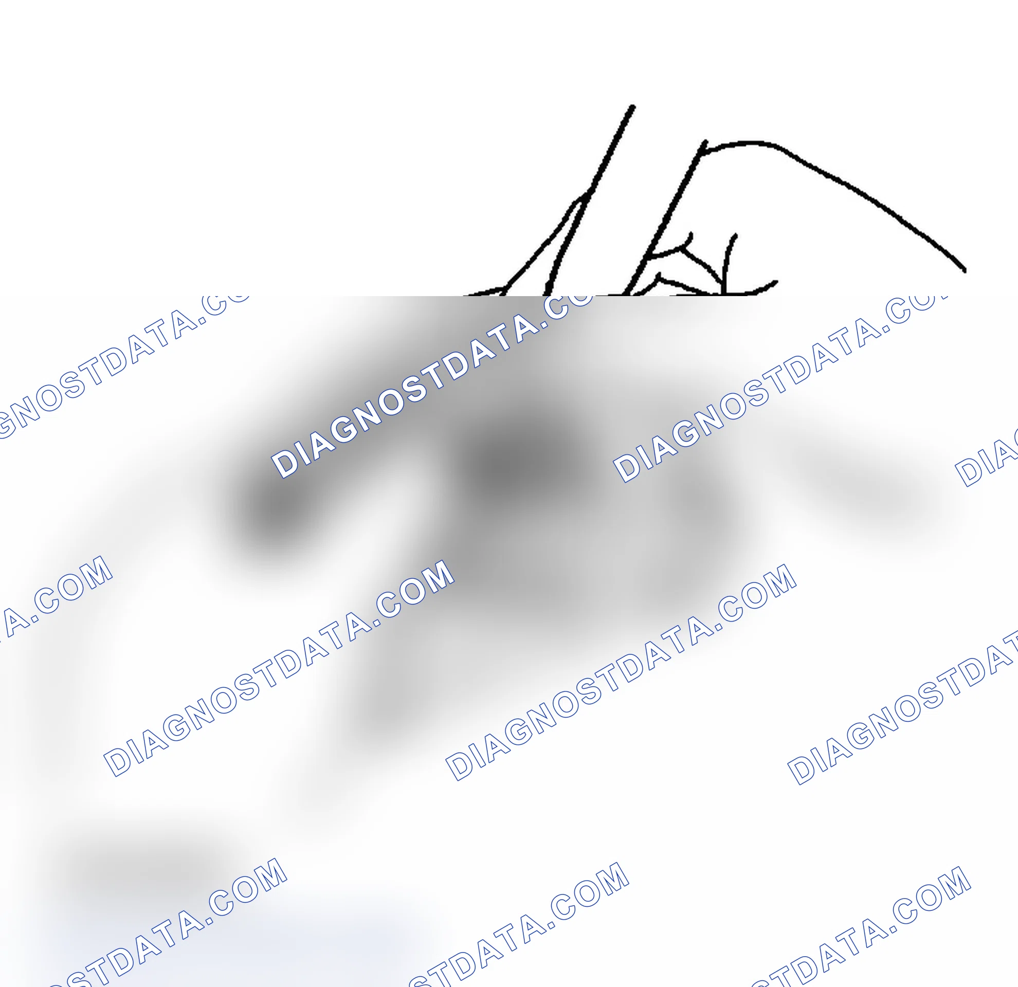 Scheme 306: REASSEMBLY