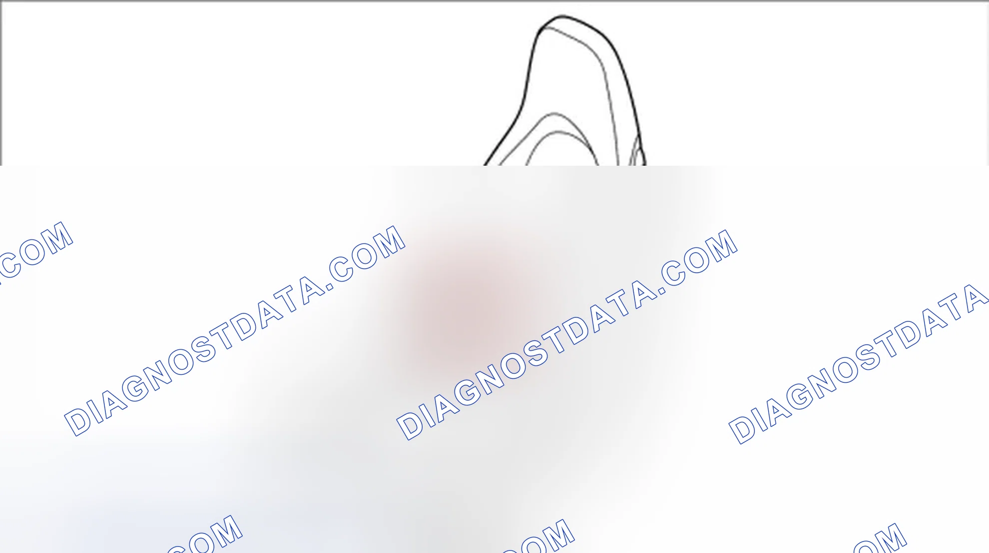 Scheme 163: Removing backrest side support