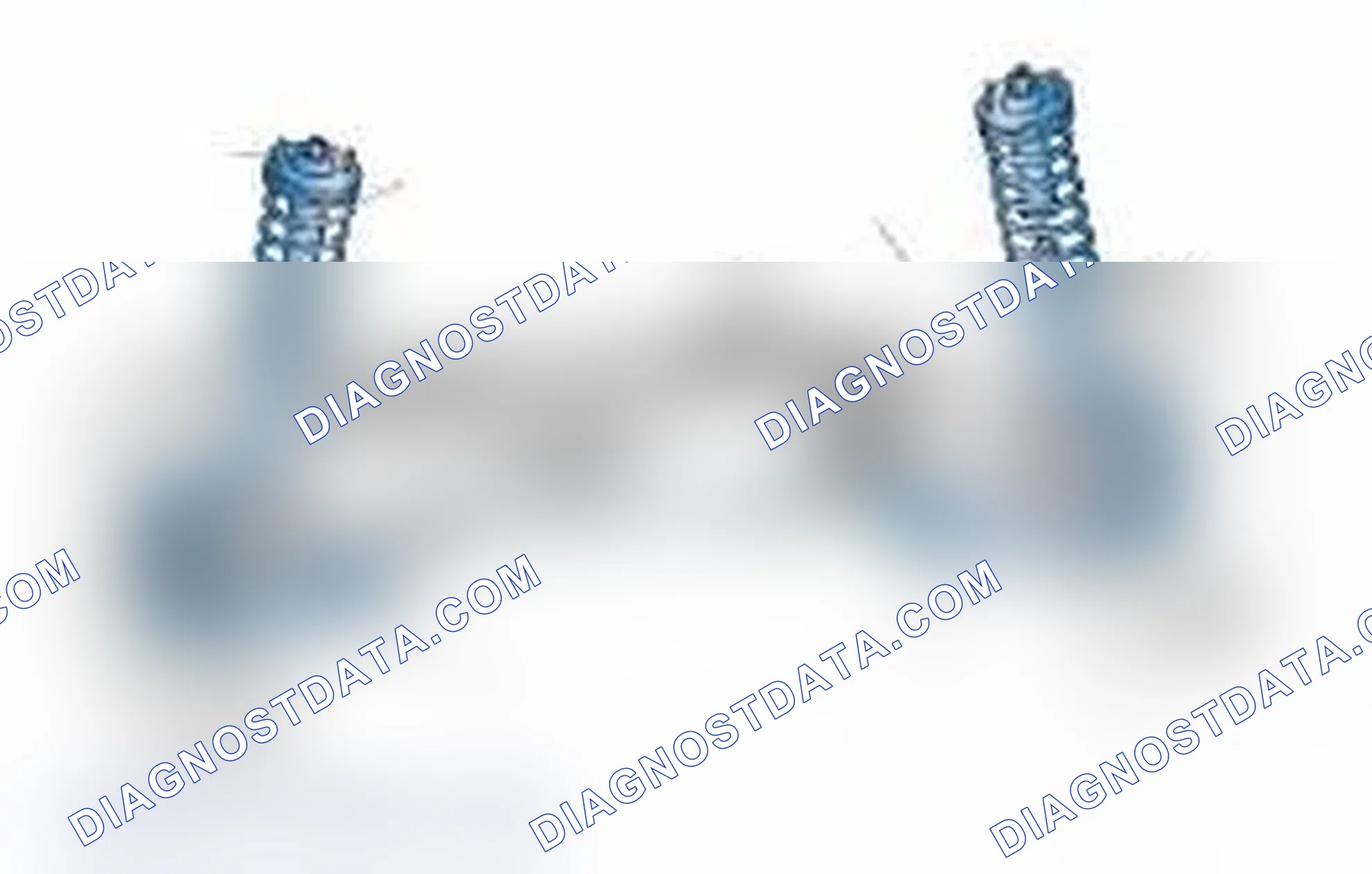 Scheme 25: Typical Front Suspension & Steering Components