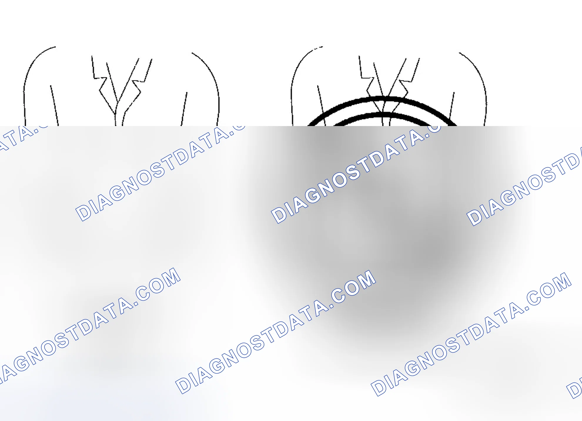 Scheme 3: Air Bag Module Handling