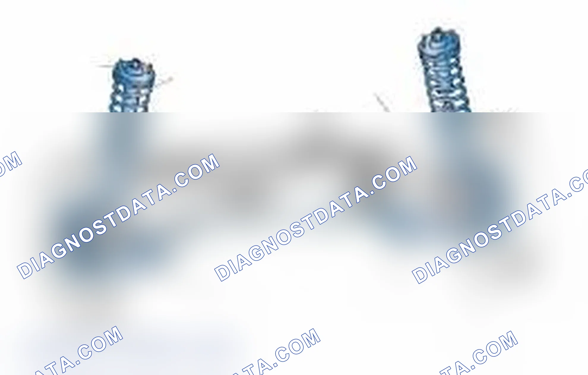Scheme 25: Typical Front Suspension & Steering Components