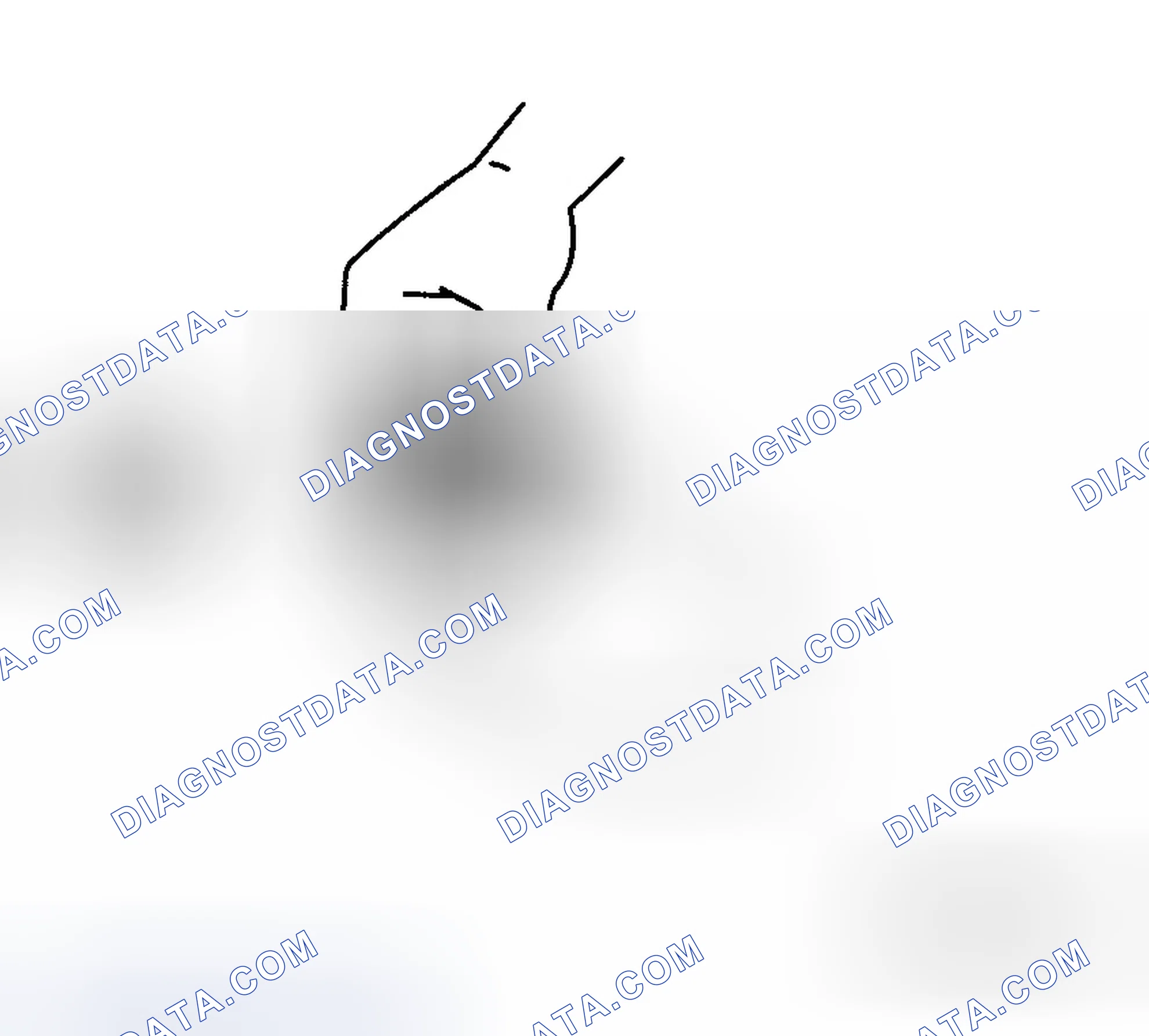Scheme 17: Inspection During Removal, Disassembly