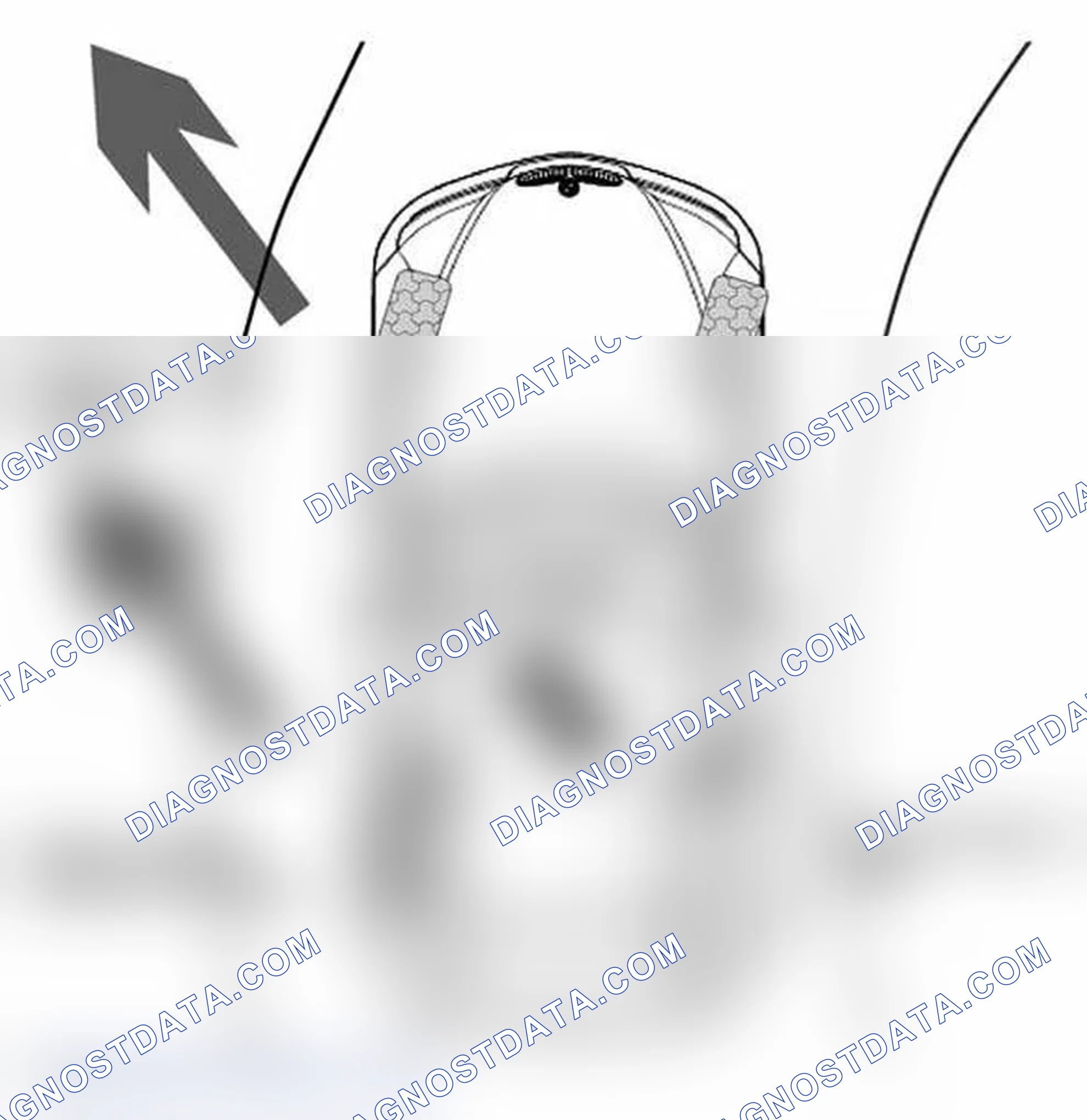Scheme 95: Corner Brake Control (CBC)