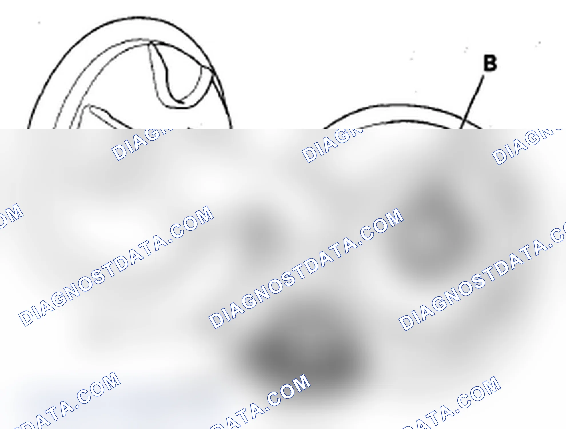 Scheme 45: DTC P0457: EVAP System Leak Detected/Fuel Fill Cap Loose or Missing