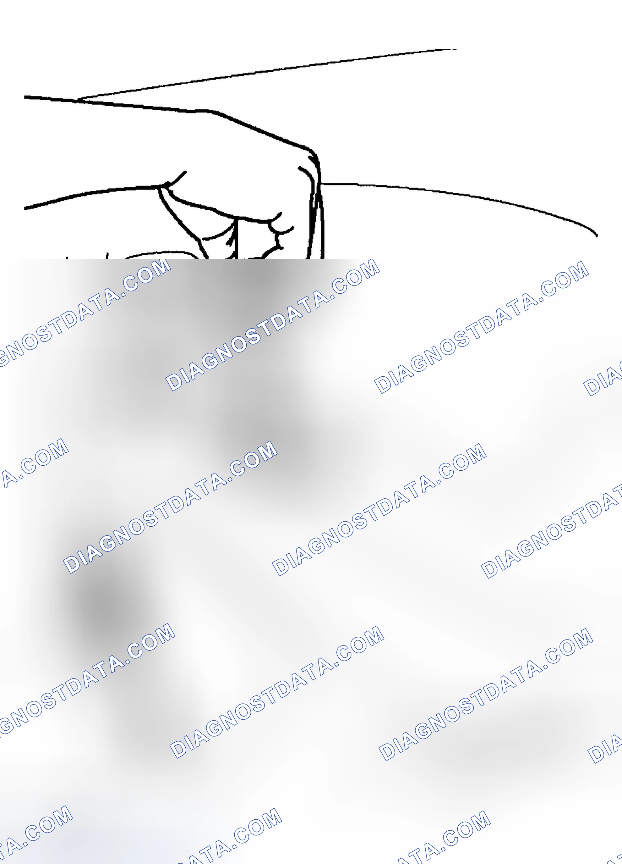 Scheme 12: Removal