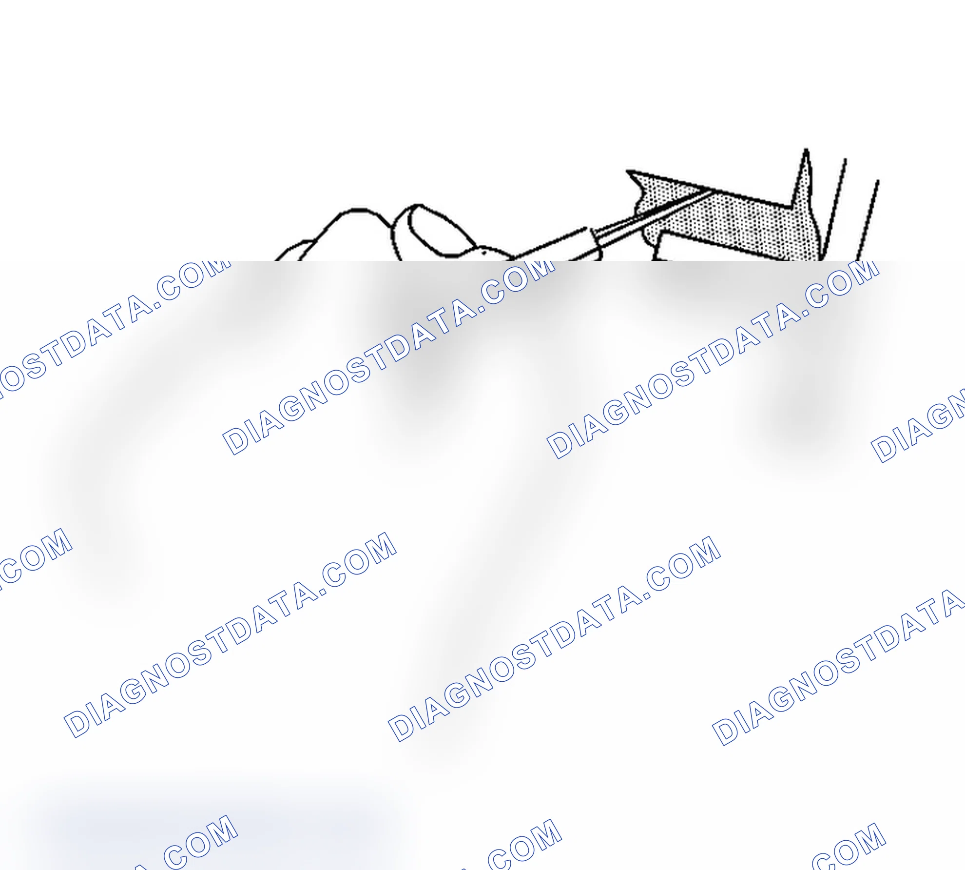 Scheme 5: Body Waterleak Repair