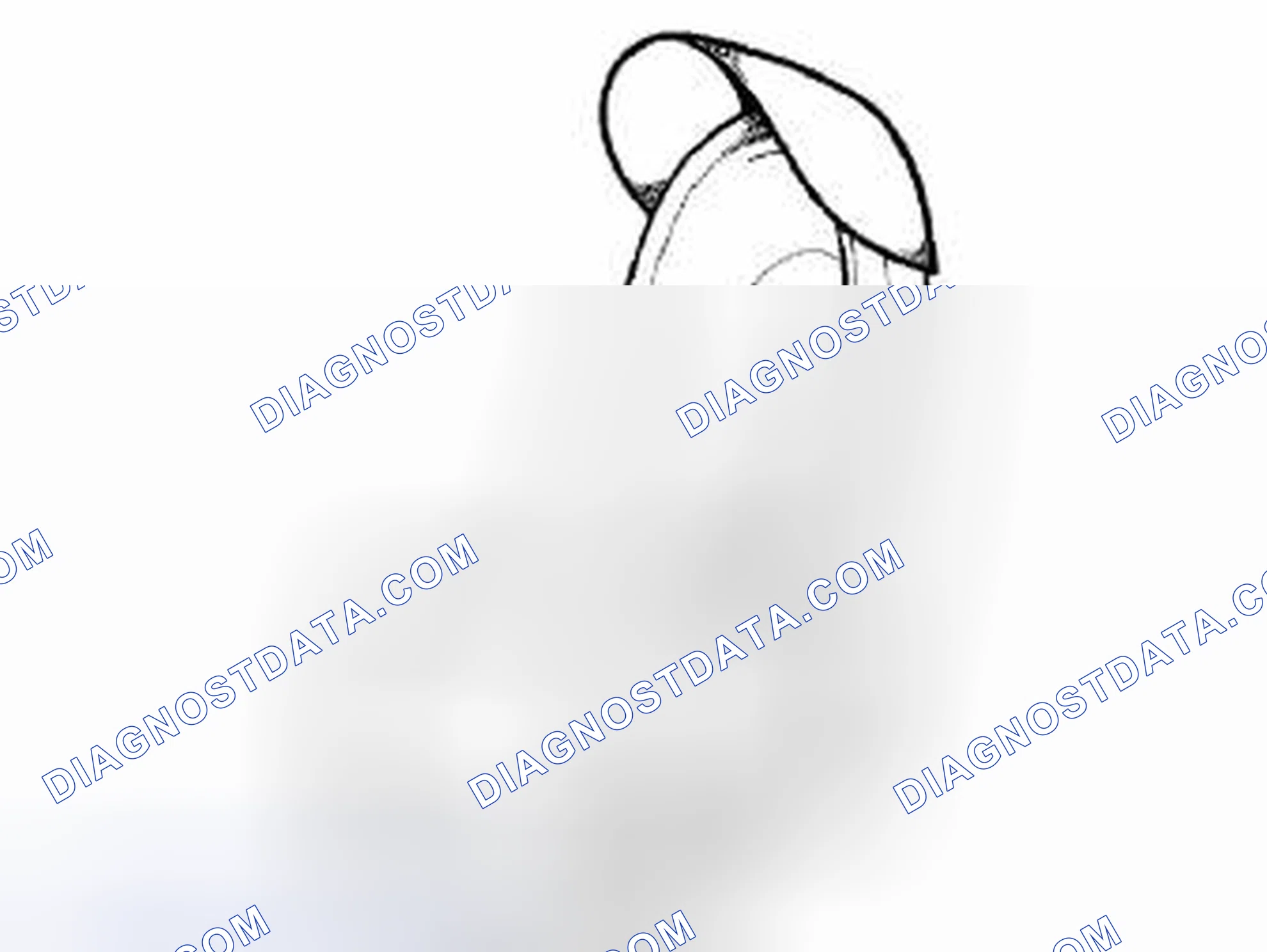 Scheme 83: SUN VISOR