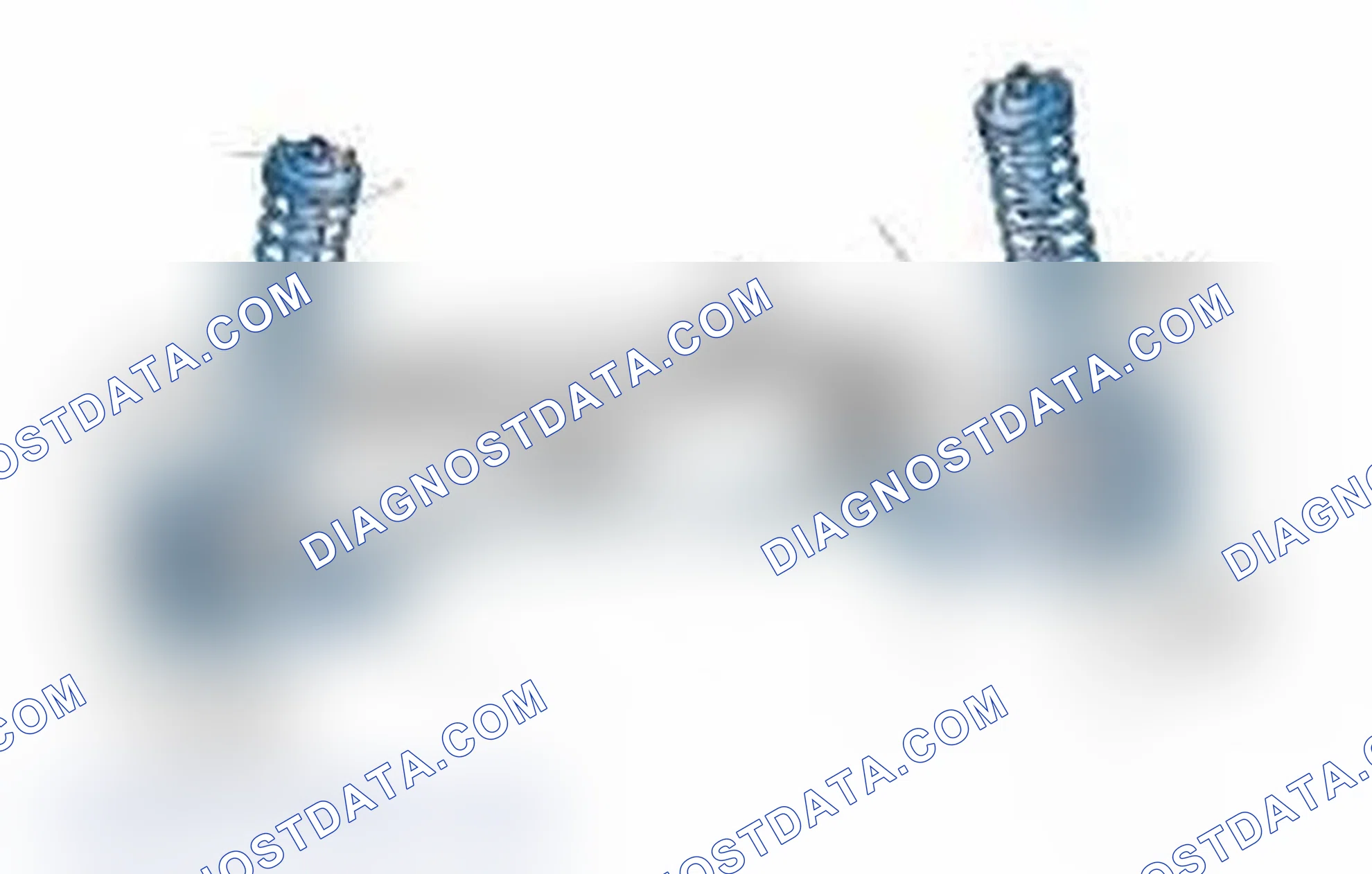 Scheme 25: Typical Front Suspension & Steering Components