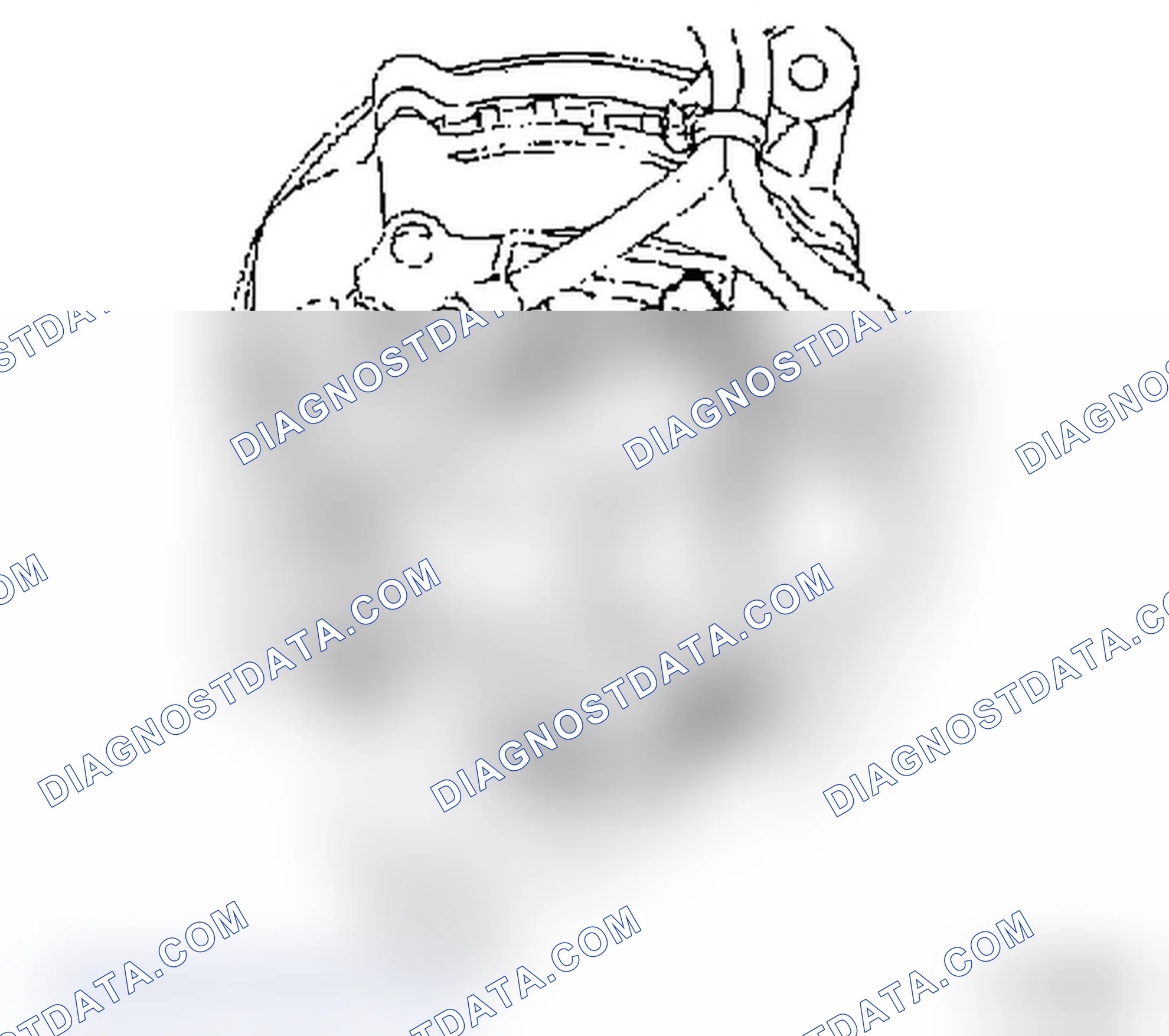 Alternator, Disassemble