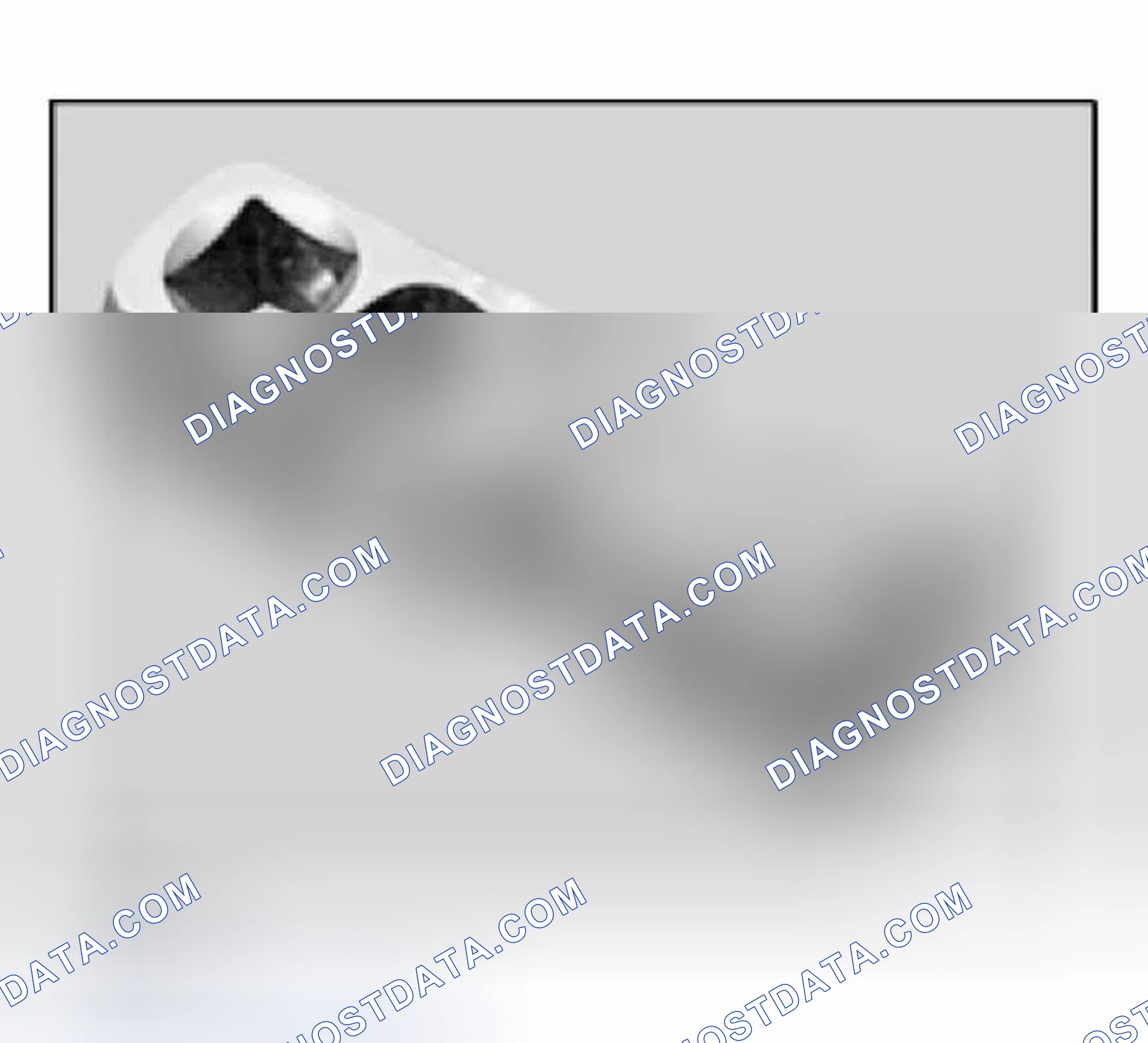 Scheme 435: Minimum Set: Mechanical Tools