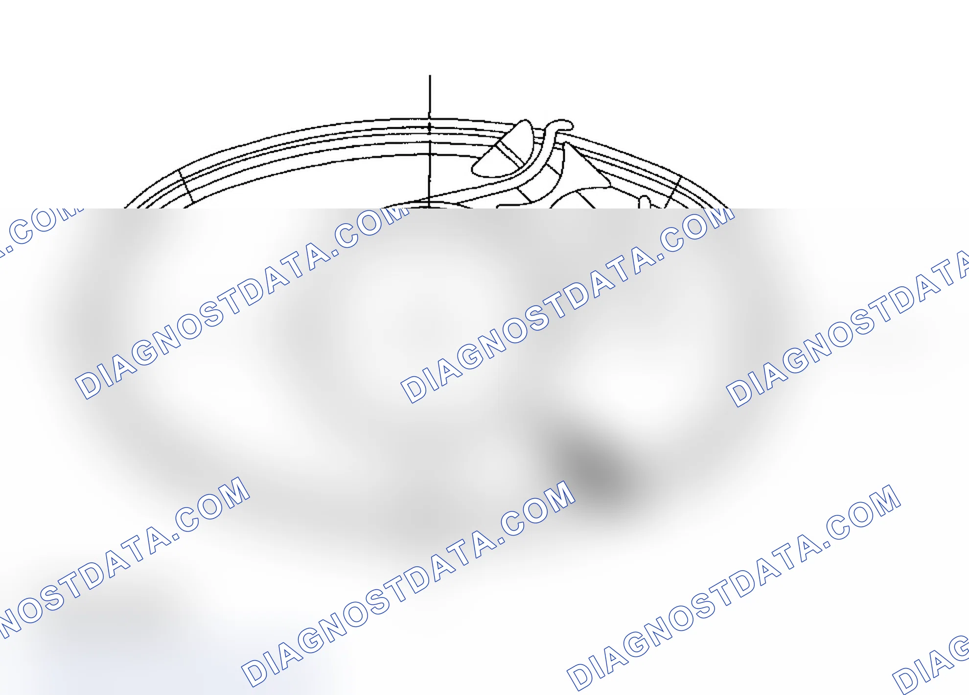 Scheme 4: Torca® Clamp