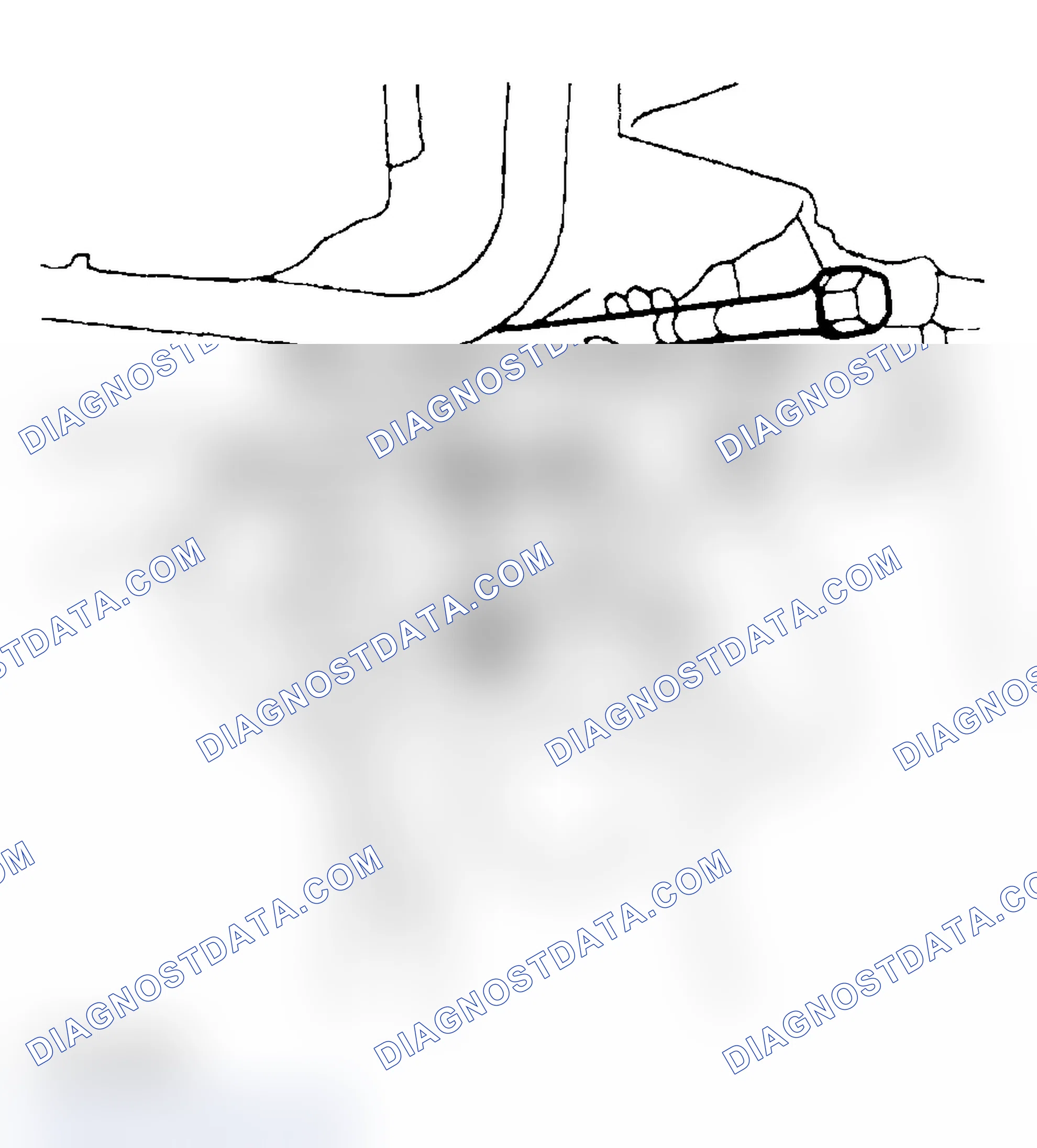 Scheme 63: Installation Procedure