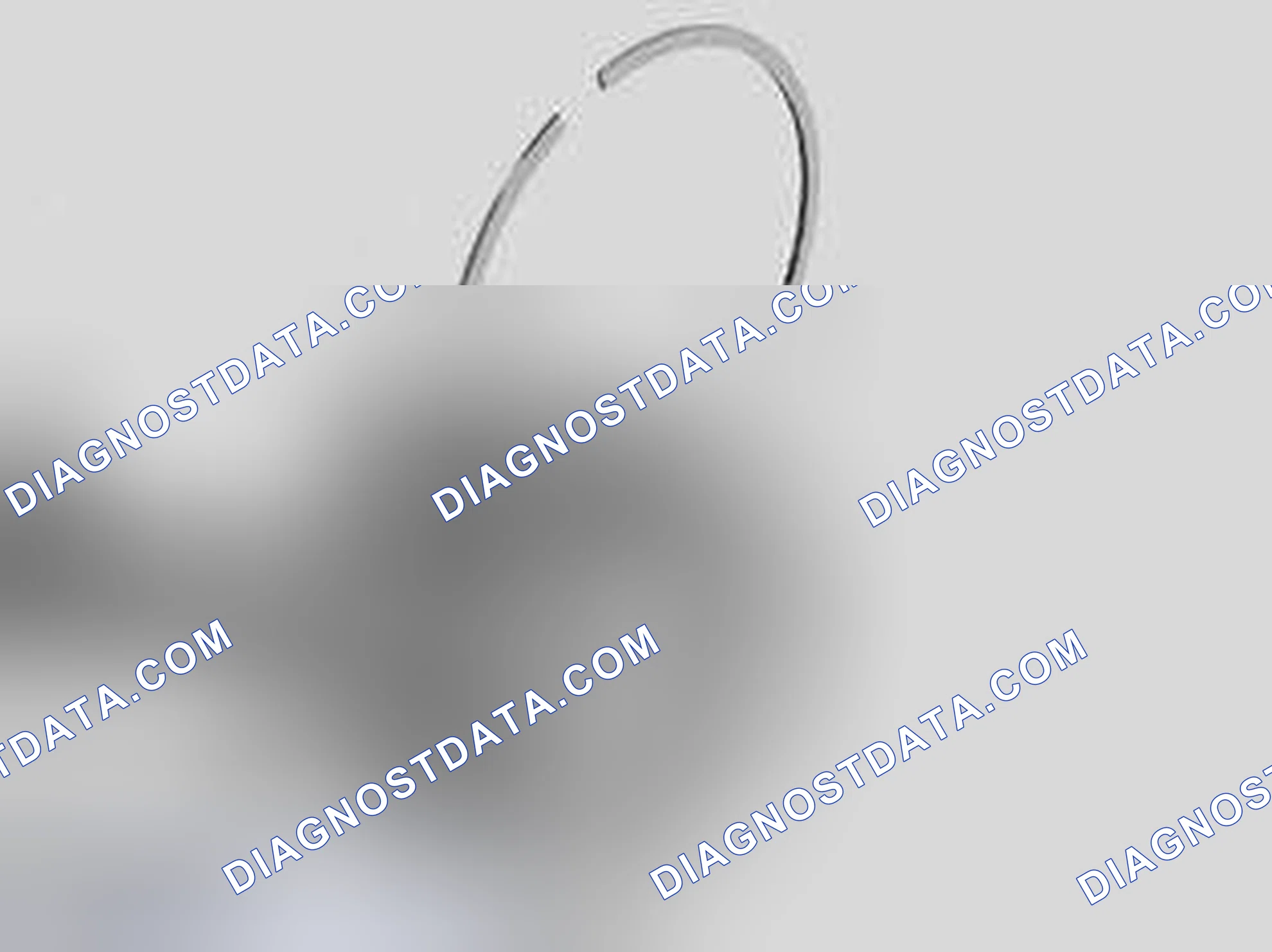 Scheme 238: CHECKING PISTON RING AXIAL CLEARANCE