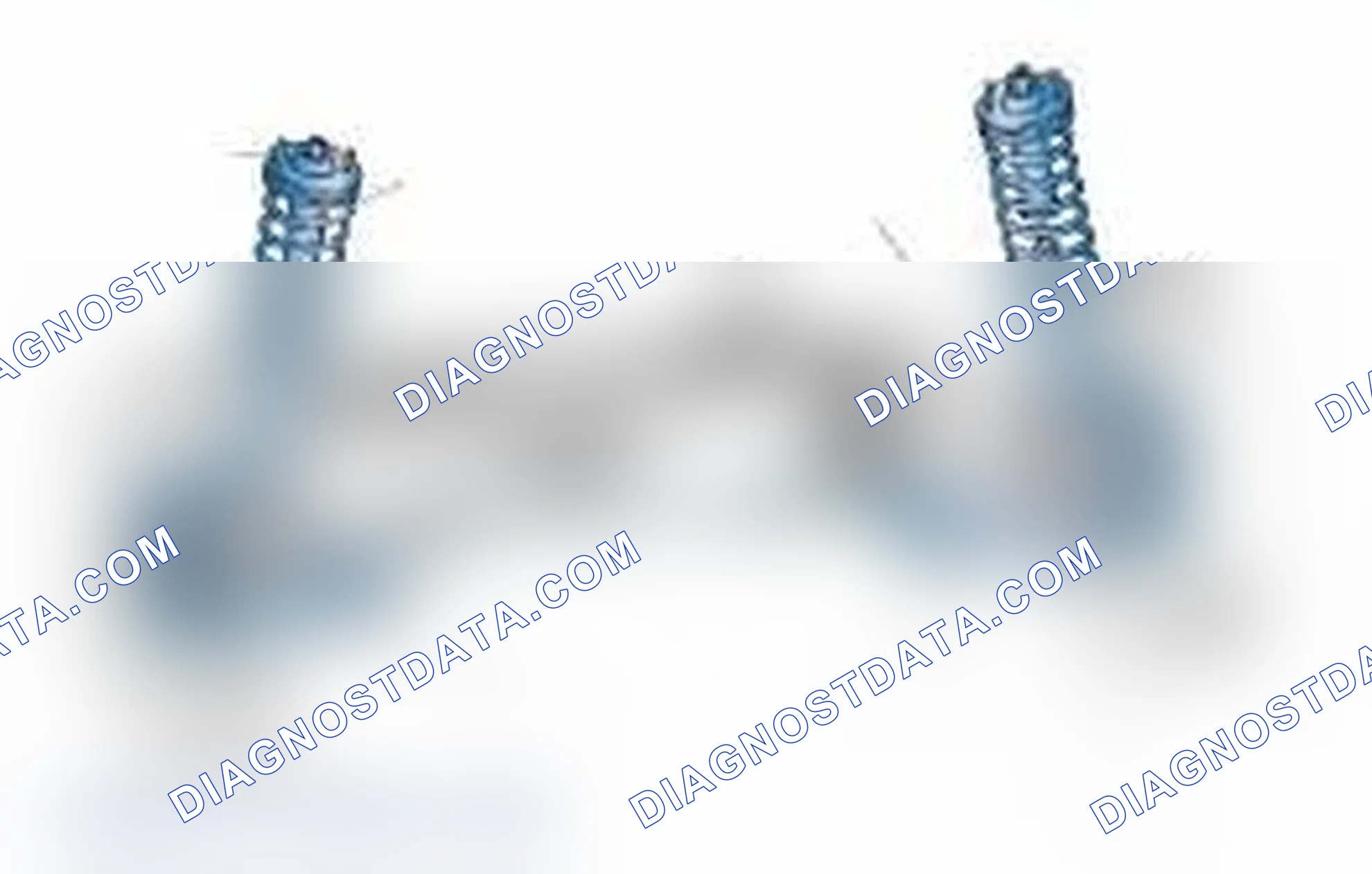 Scheme 25: Typical Front Suspension & Steering Components