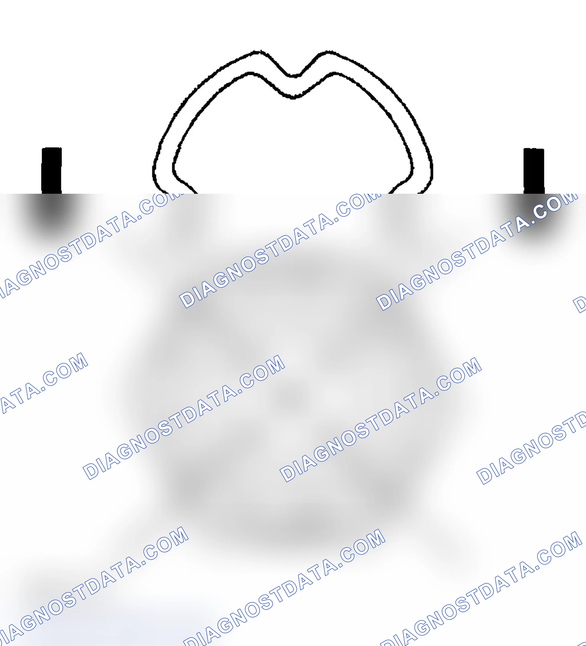 Scheme 93: Installation Procedure