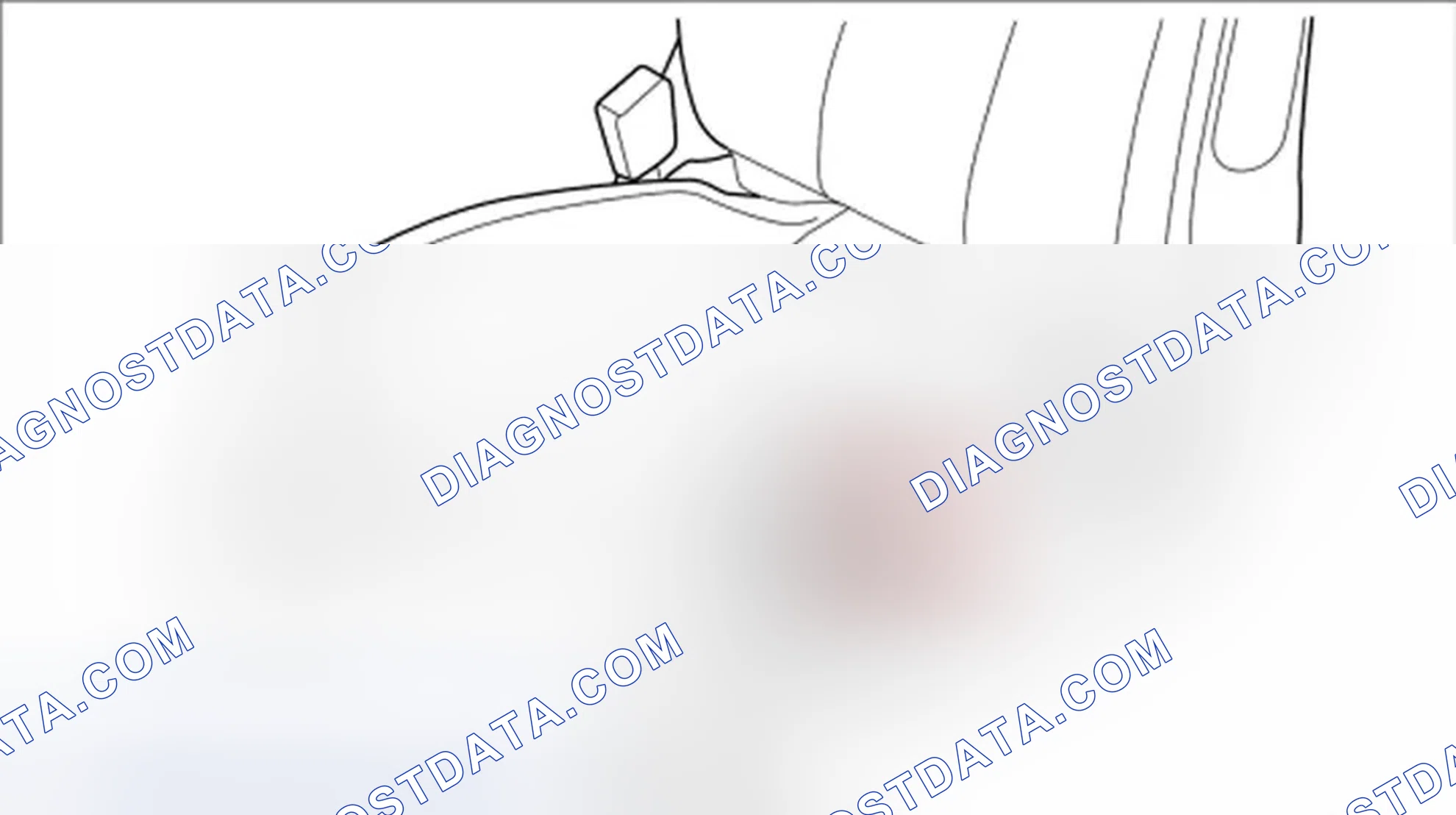 Scheme 25: Removing motor for rear vertical adjustment
