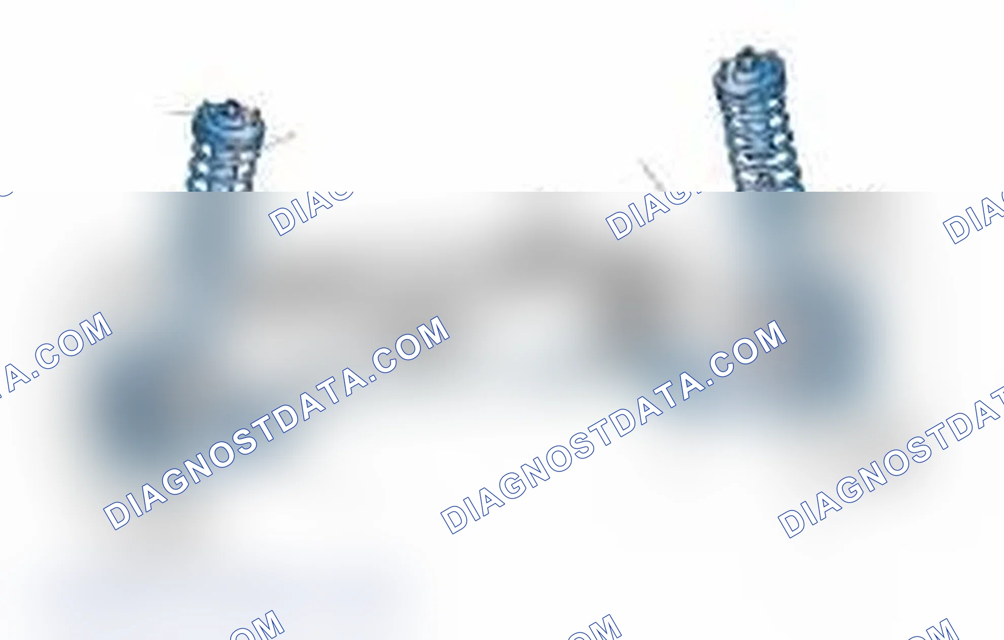 Scheme 25: Typical Front Suspension & Steering Components