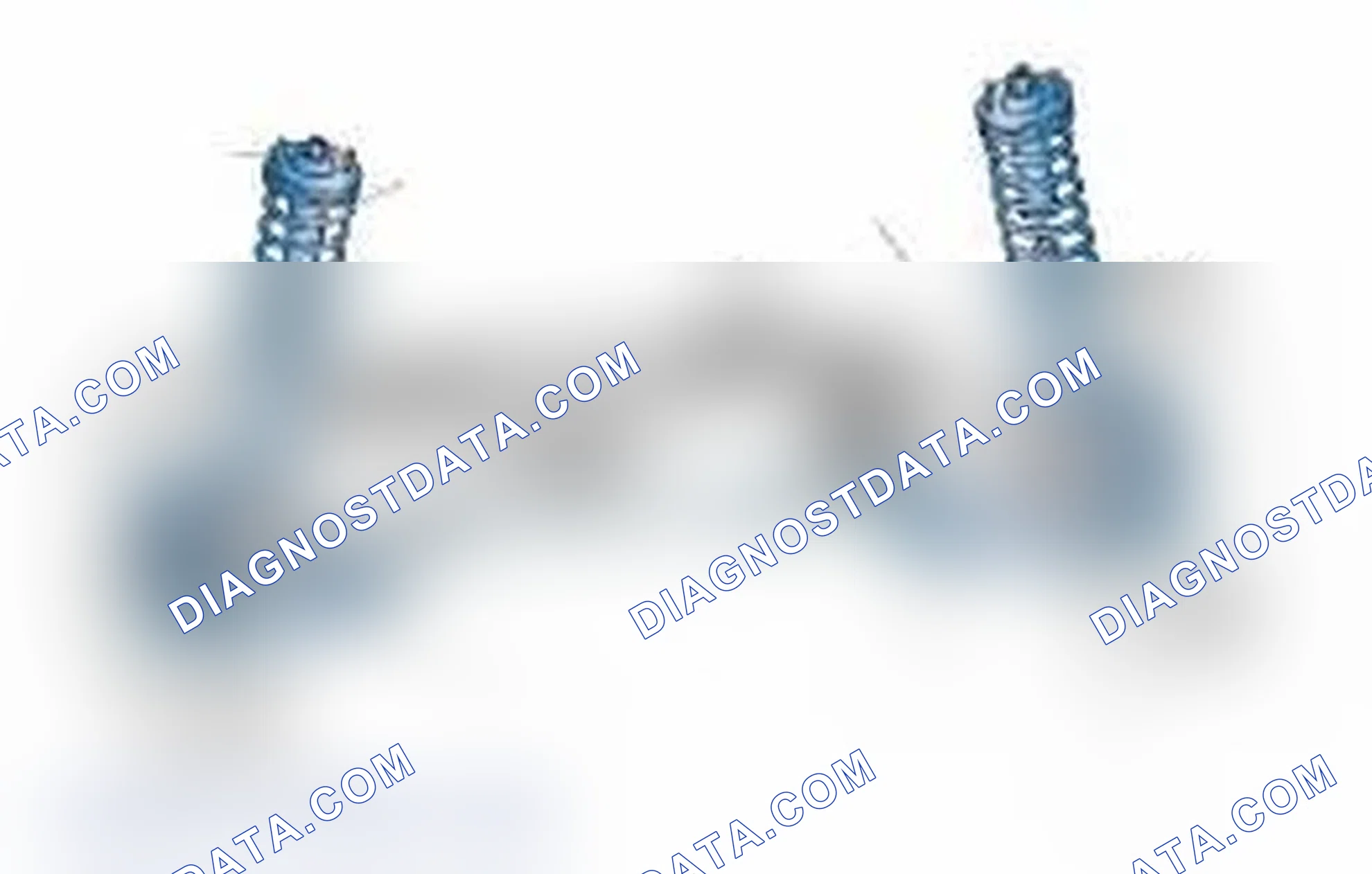 Scheme 25: Typical Front Suspension & Steering Components