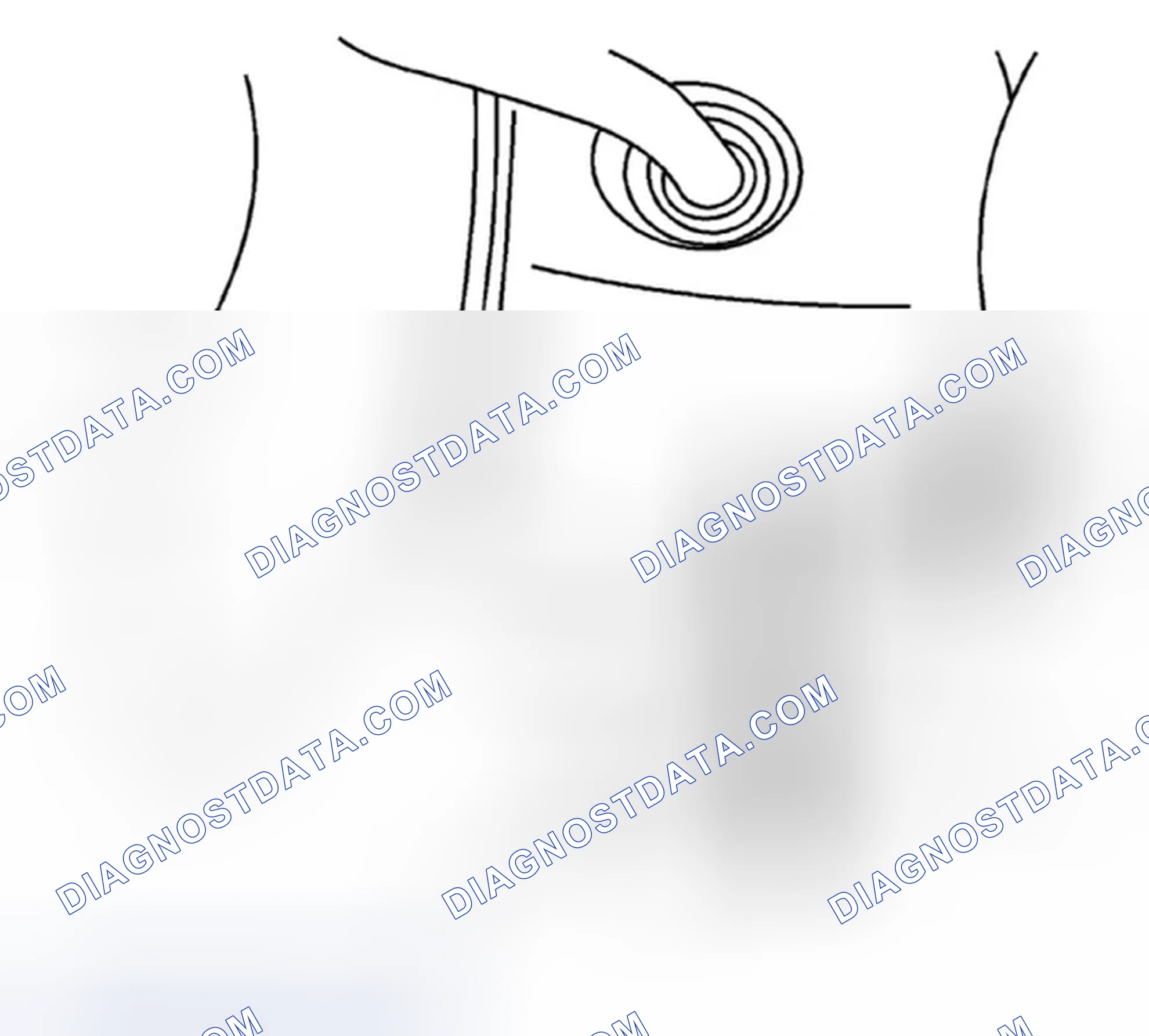 Scheme 14: Removal Procedure