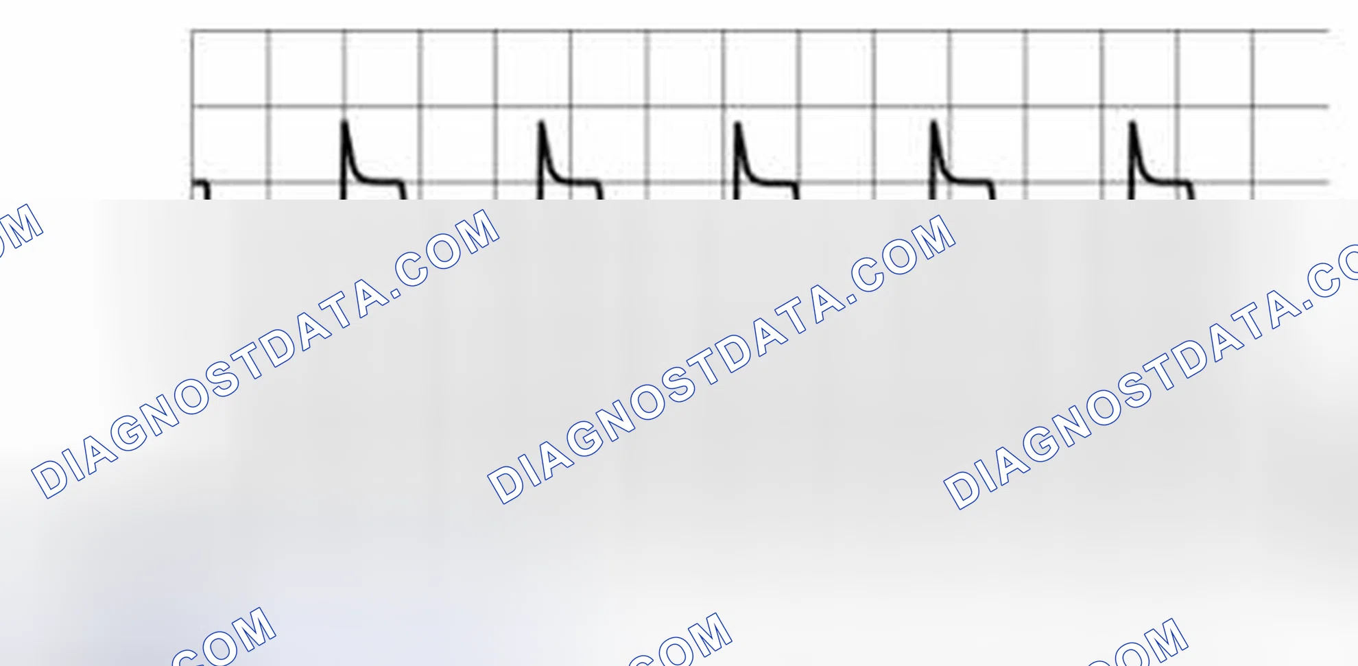 Scheme 81: BCM Pattern 3 (Generated Pulse)