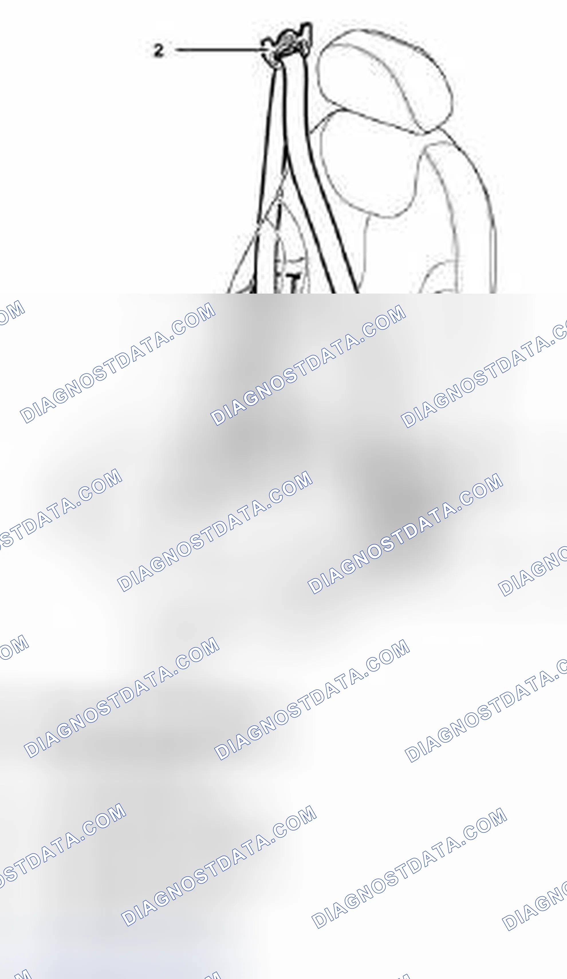 Scheme 48: Seat Belts