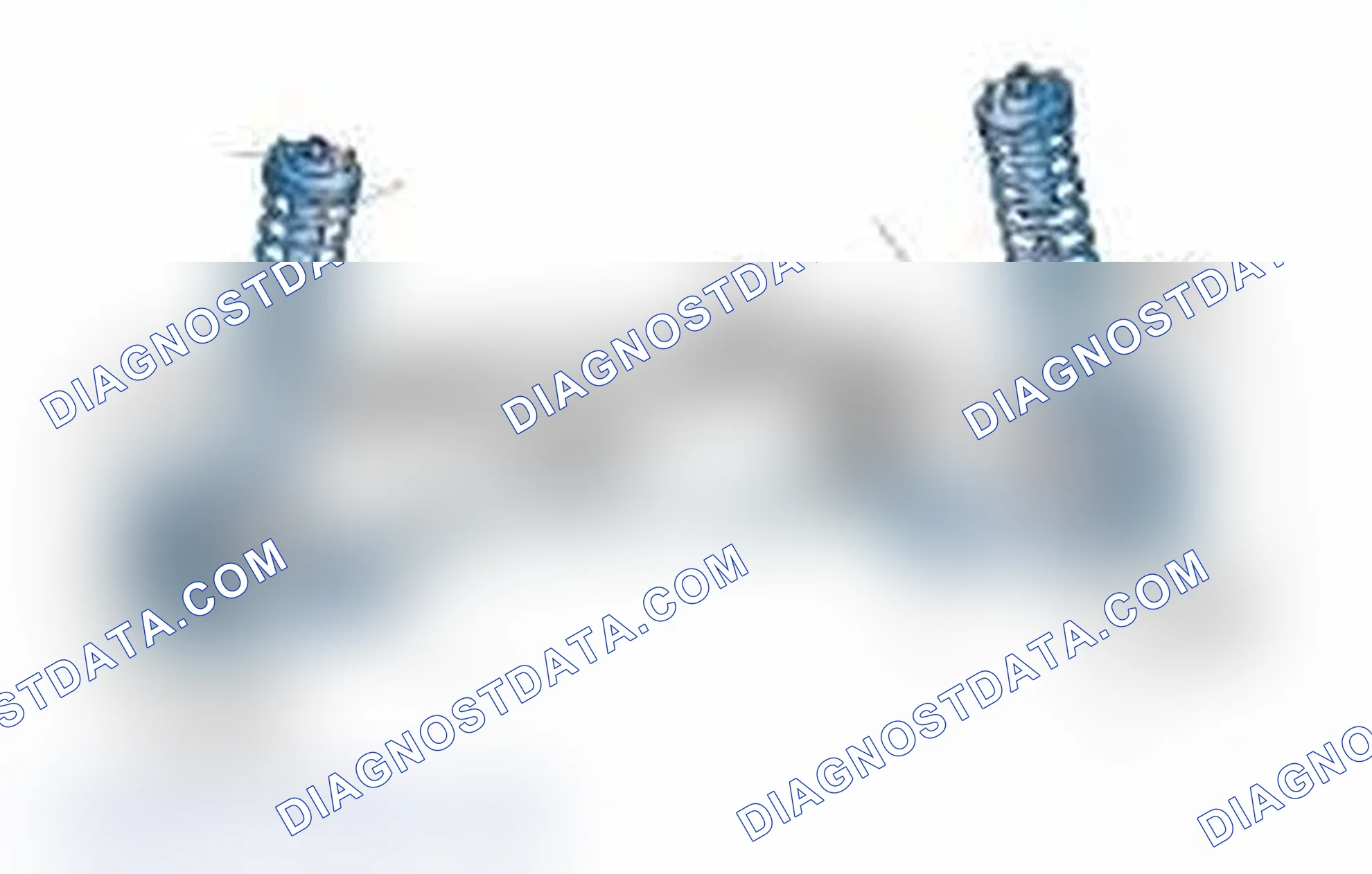 Scheme 25: Typical Front Suspension & Steering Components